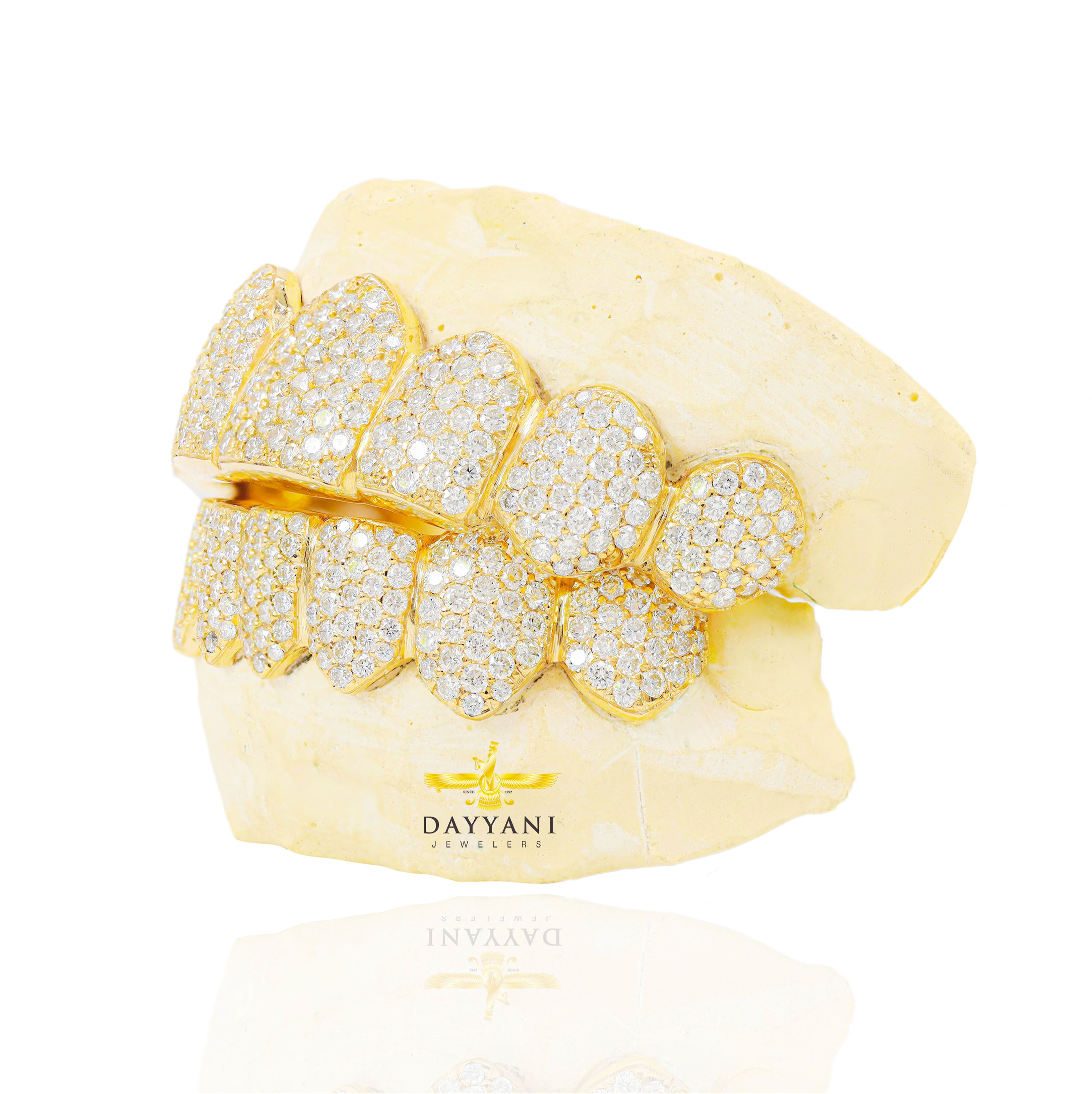 Custom VVS Clarity Diamond Grillz Hand Set Natural Diamonds Gold Grillz (Zig-Zag Setting)