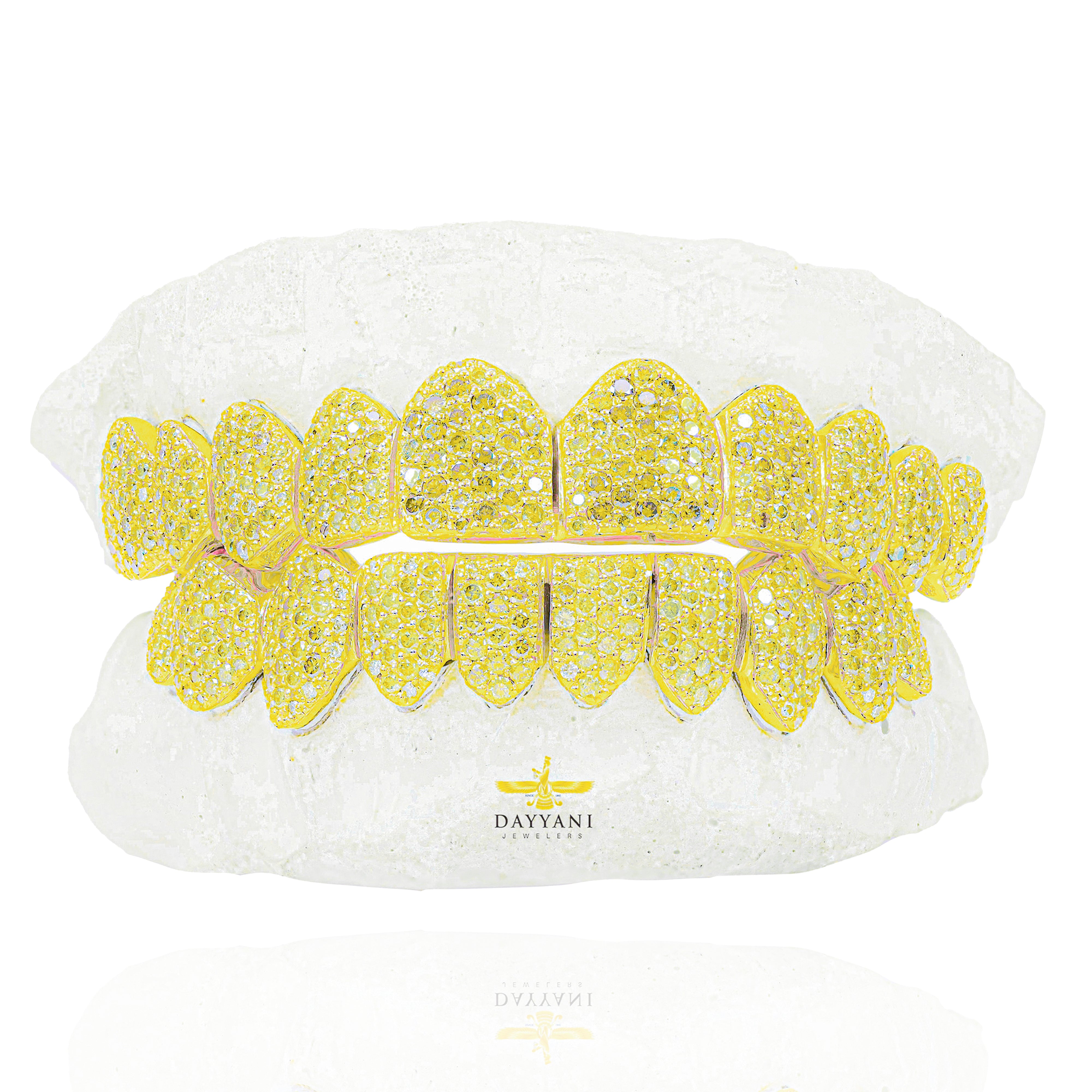 Custom Canary Hand Set Diamond Grillz Solid Gold Grillz (Zig-Zag Setting)