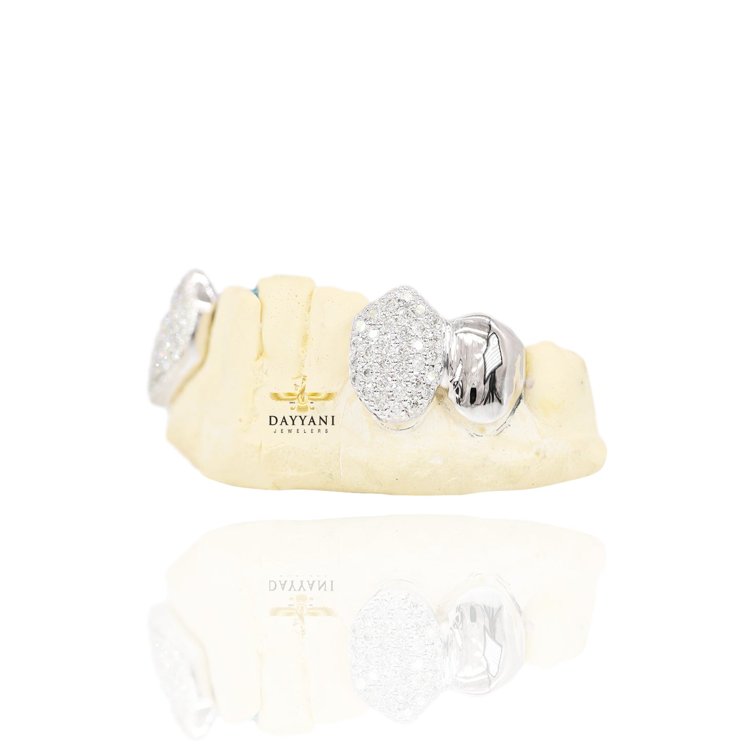 Custom 2 Teeth Diamond Grillz with Solid Ends Gold Grillz