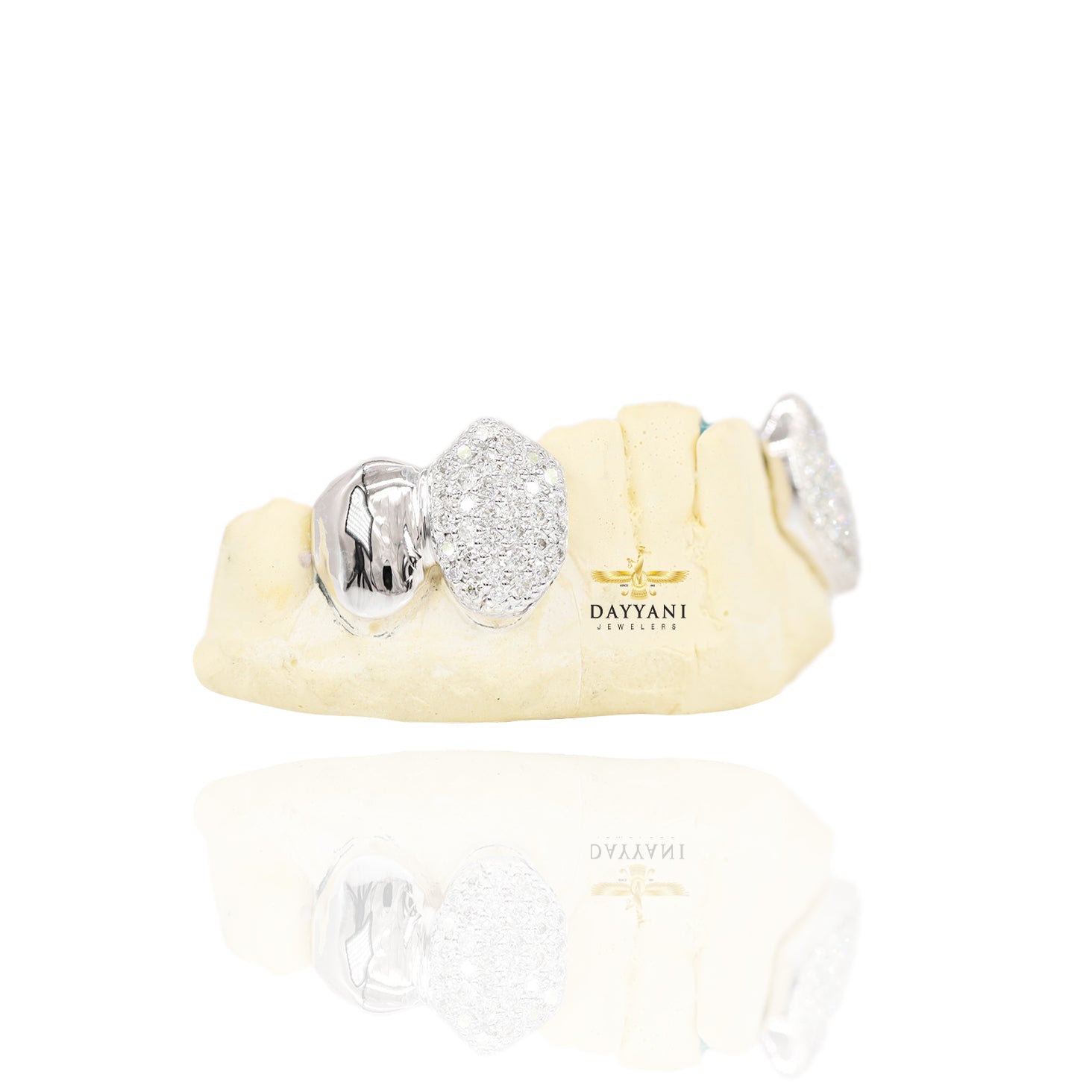 Custom 2 Teeth Diamond Grillz with Solid Ends Gold Grillz