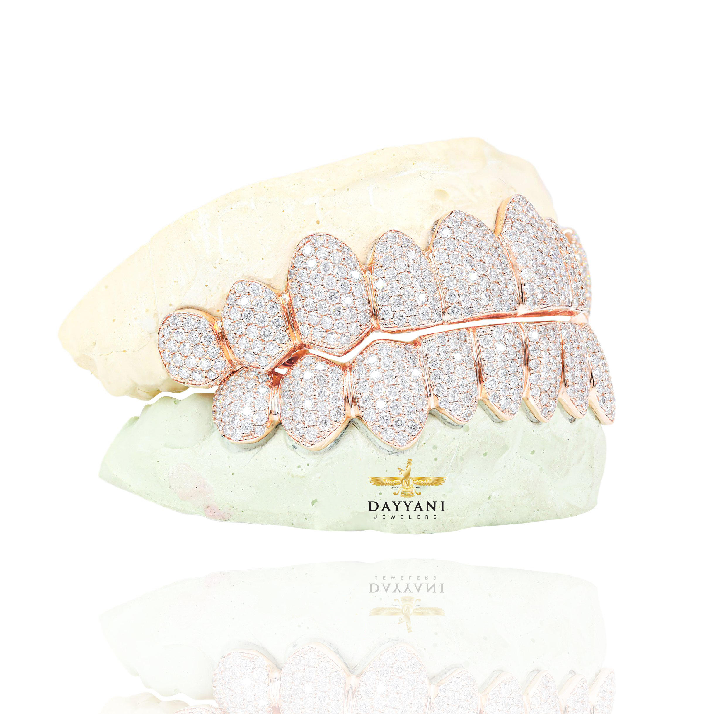 Custom VVS Clarity Diamond Grillz Hand Set Natural Diamonds Gold Grillz (Zig-Zag Setting)