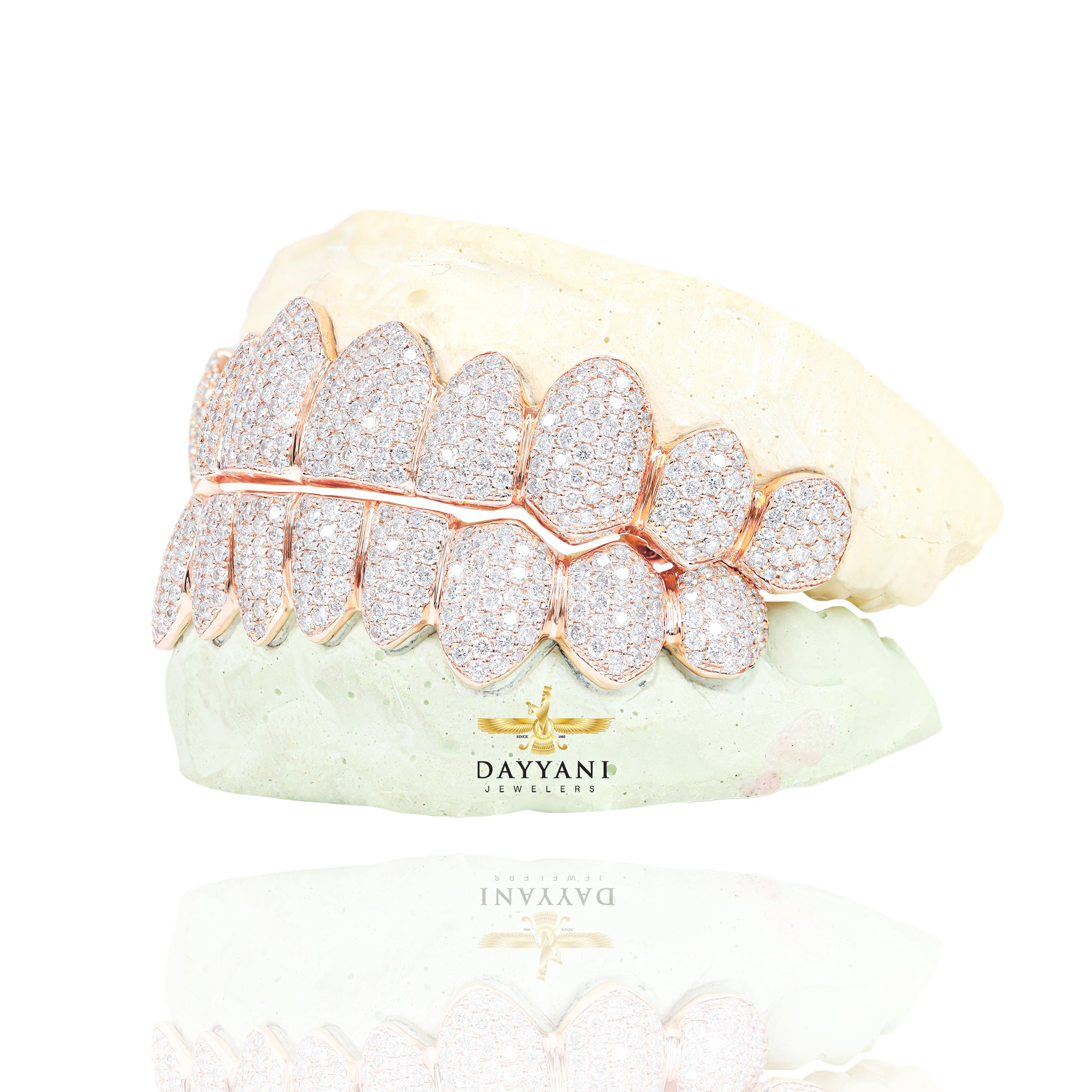 Custom VVS Clarity Diamond Grillz Hand Set Natural Diamonds Gold Grillz (Zig-Zag Setting)