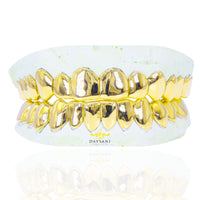 Custom Metamorphic Style Solid Gold Grillz