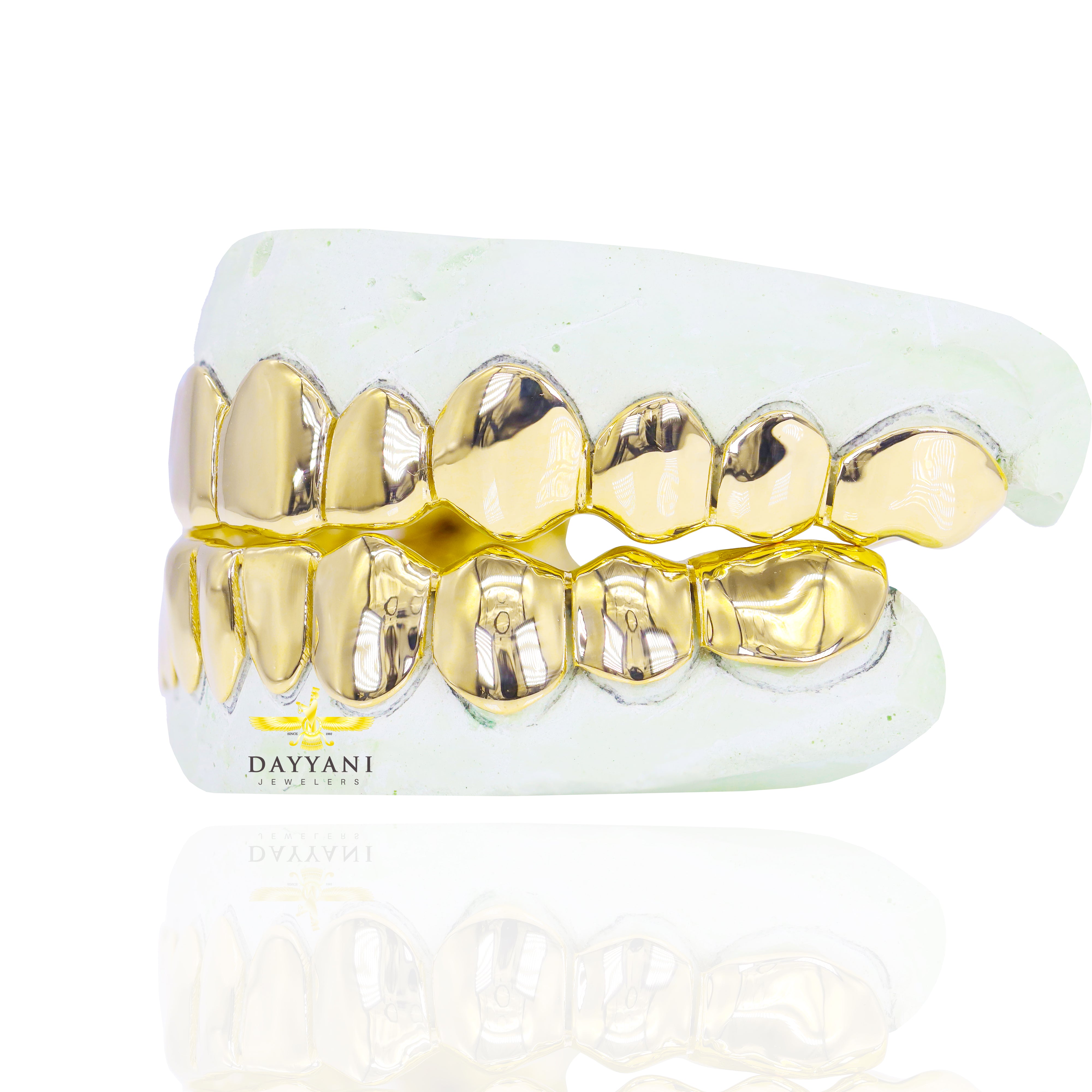 Custom 12 on 12 Gold Grillz Wall To Wall