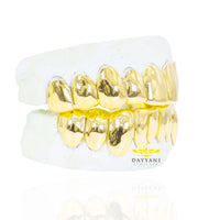 Custom Grillz Solid Gold Grillz