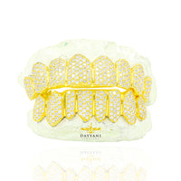 Custom Canary Hand Set Diamond Grillz Solid Gold Grillz (Zig-Zag Setting)
