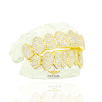 Custom I Clarity Diamond Grillz Hand Set Natural Diamonds Gold Grillz (Zig-Zag Setting)