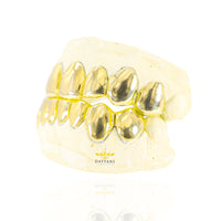 Custom 8 on 8 Gold Grillz
