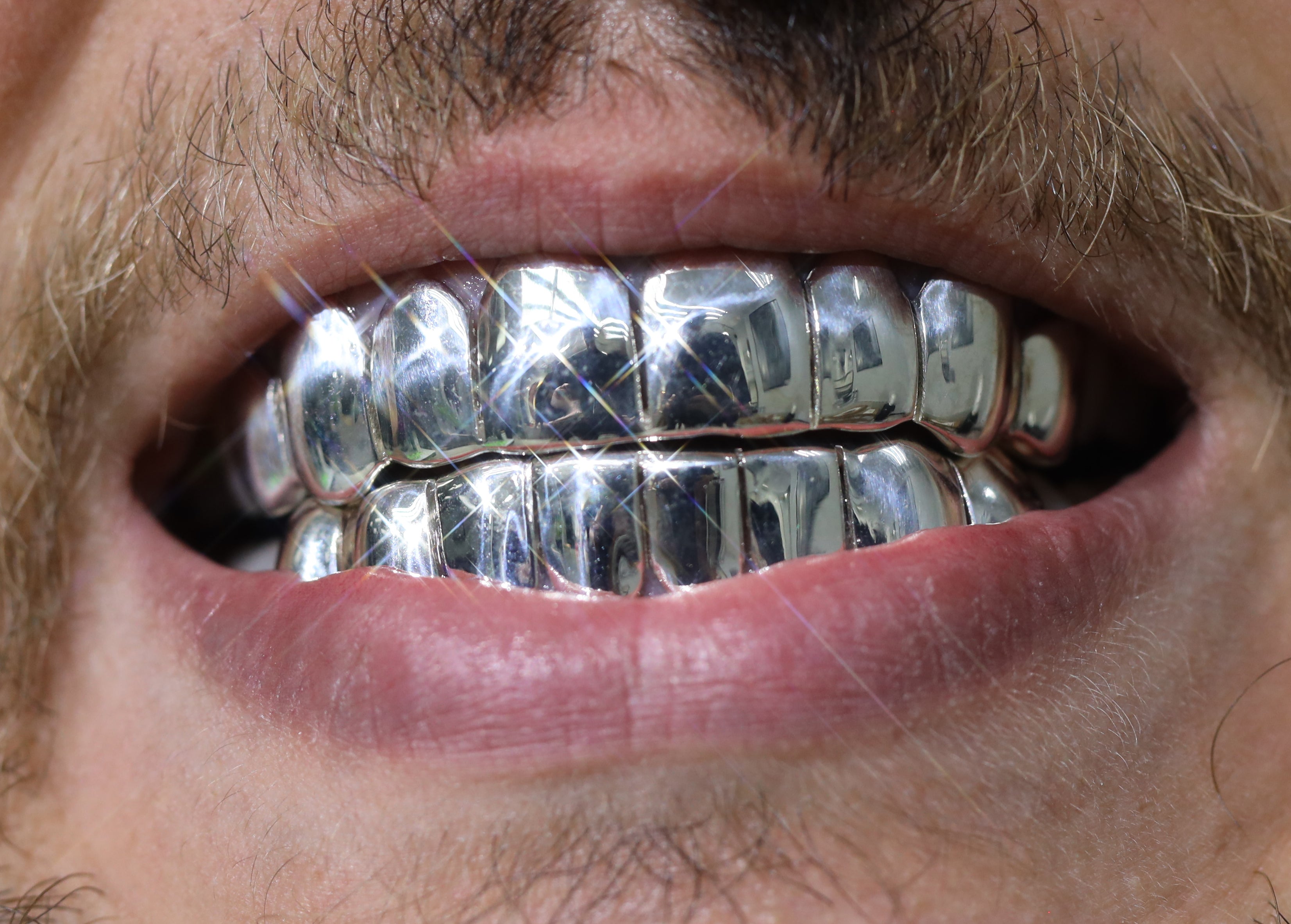 Custom 8 on 8 Gold Grillz