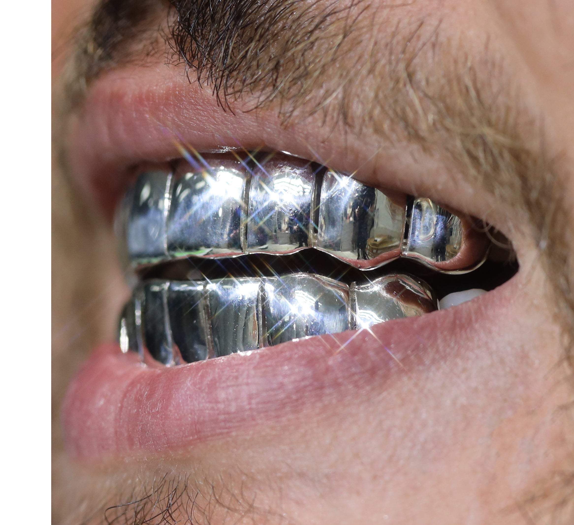 Custom 8 on 8 Gold Grillz