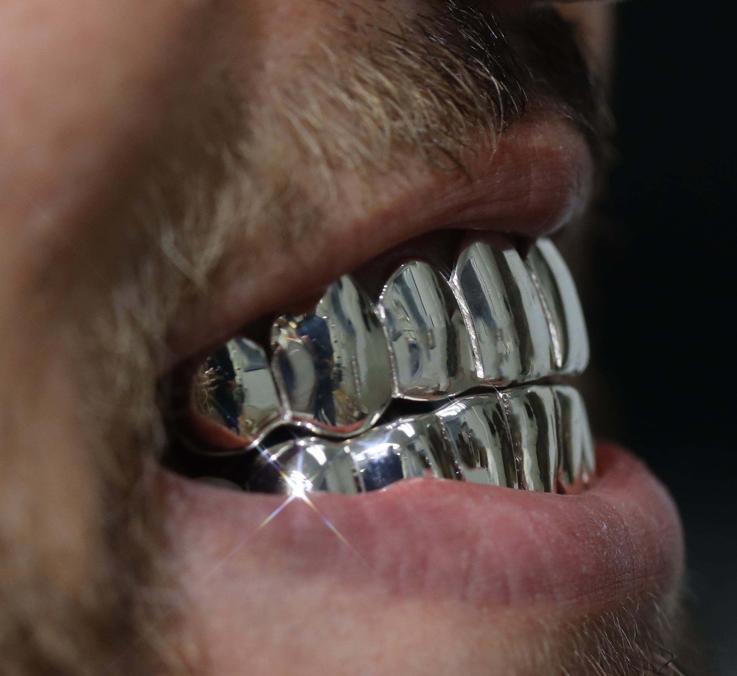 Custom 8 on 8 Gold Grillz