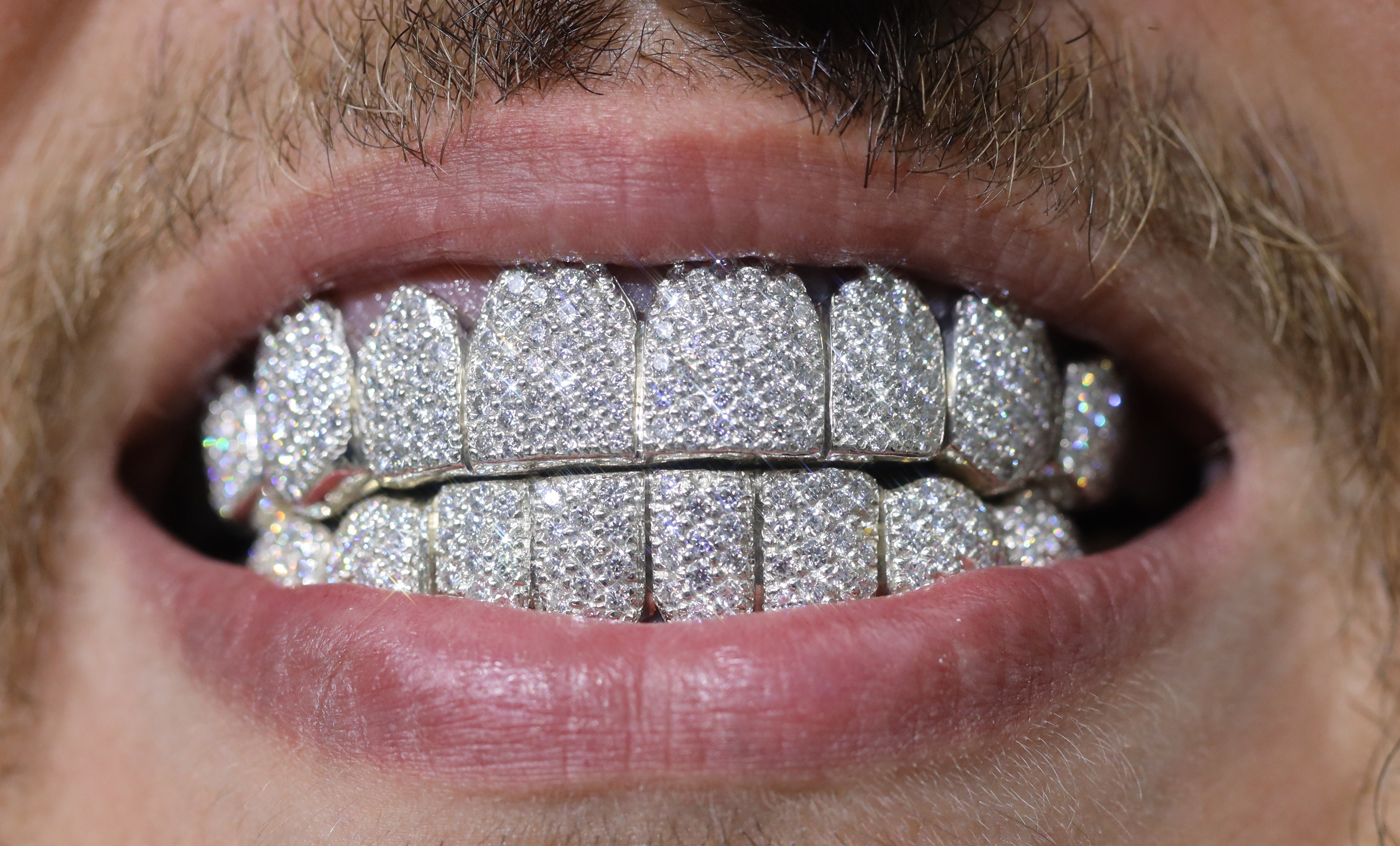 Custom SI Clarity Diamond Grillz Hand Set Natural Diamonds Gold Grillz (Zig-Zag Setting)