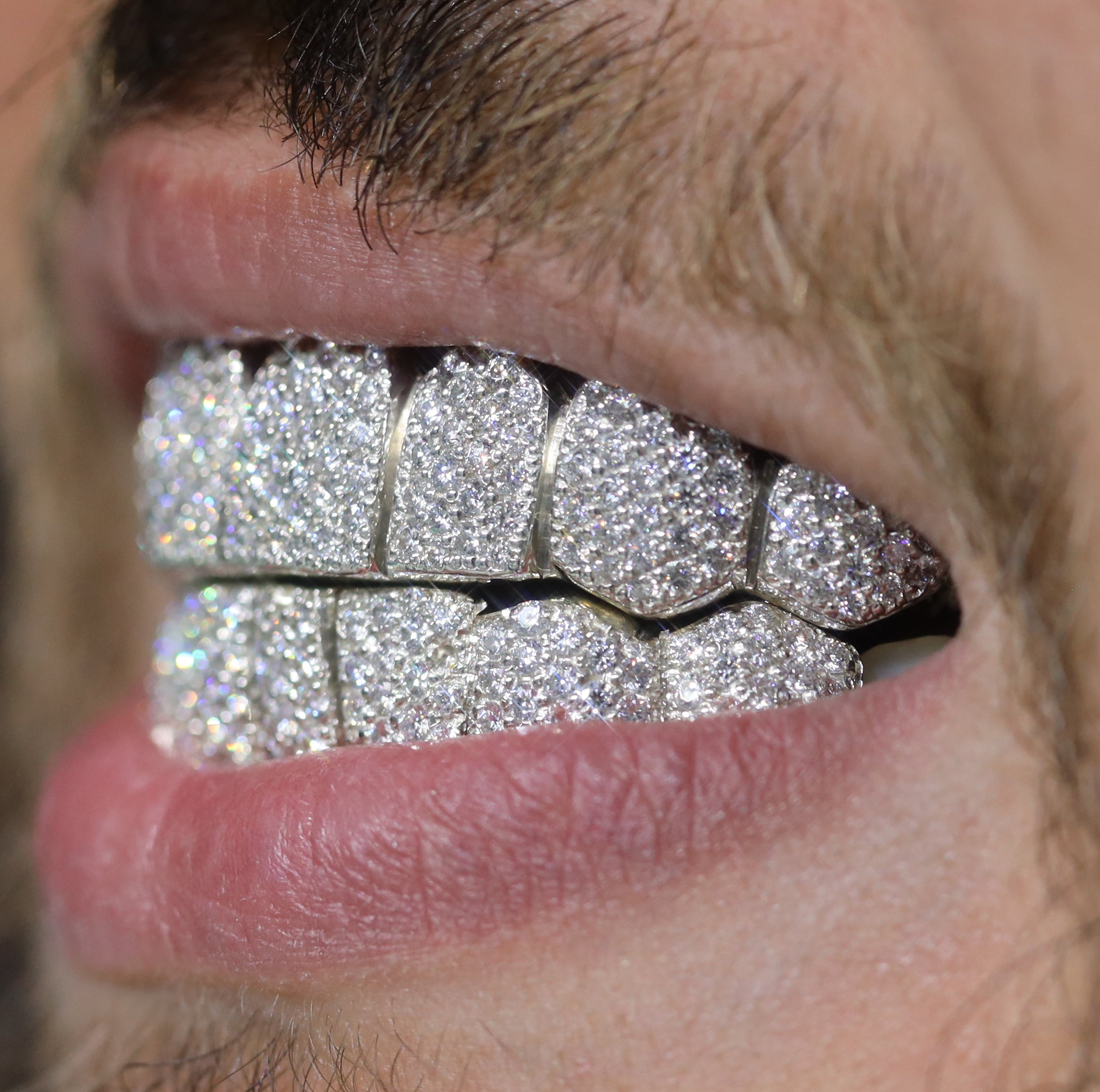 Custom SI Clarity Diamond Grillz Hand Set Natural Diamonds Gold Grillz (Zig-Zag Setting)