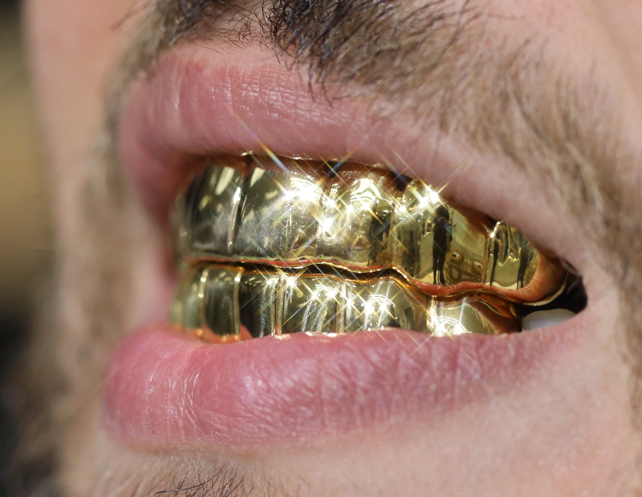 Custom Grillz Solid Gold Grillz