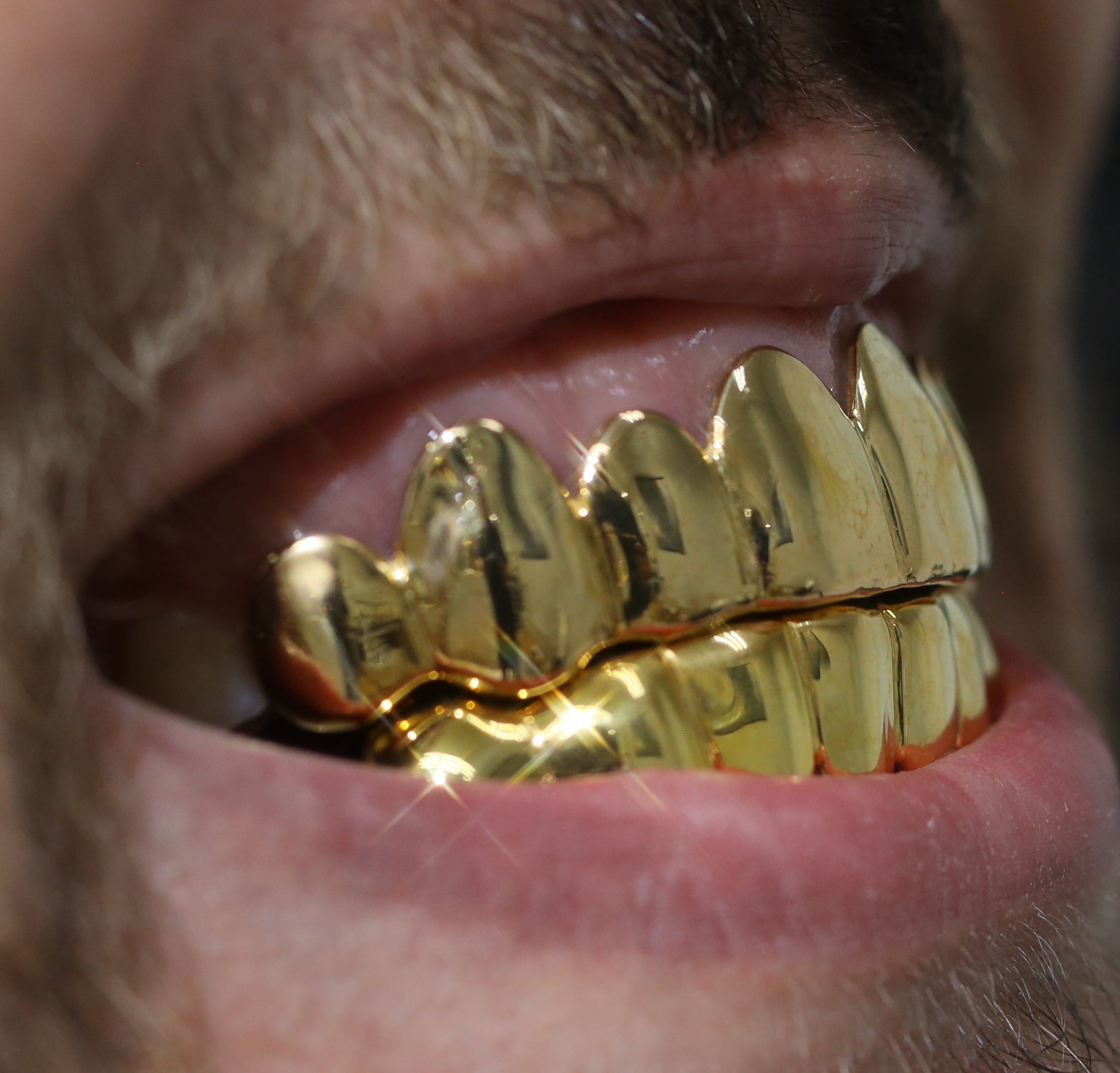 Custom 8 on 8 Gold Grillz