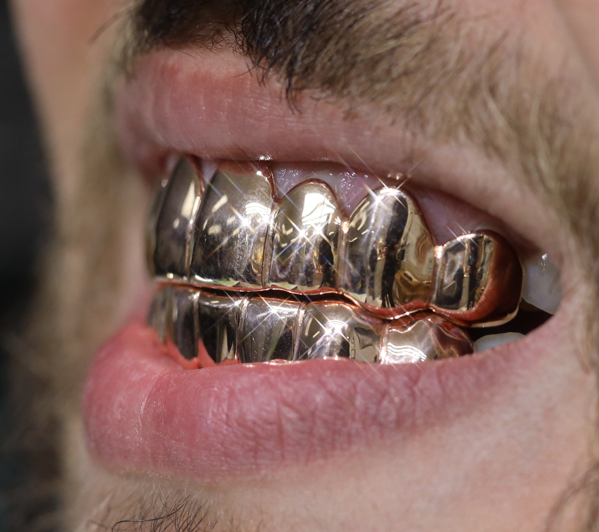 Custom 8 on 8 Gold Grillz