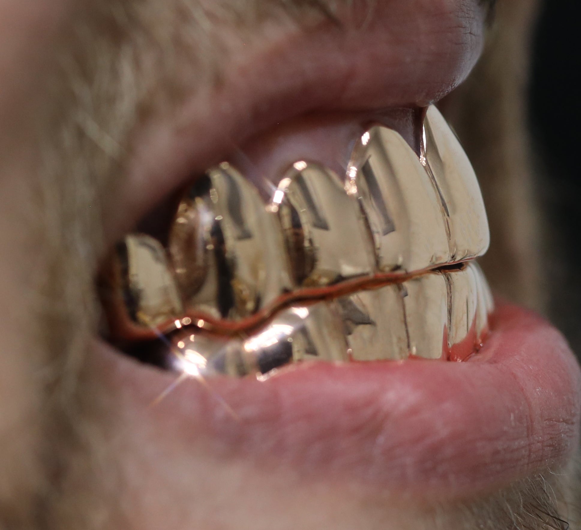 Close-up of a person wearing gold grillz on their teeth.