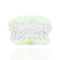 Custom Canary Hand Set Diamond Grillz Solid Gold Grillz (Zig-Zag Setting)