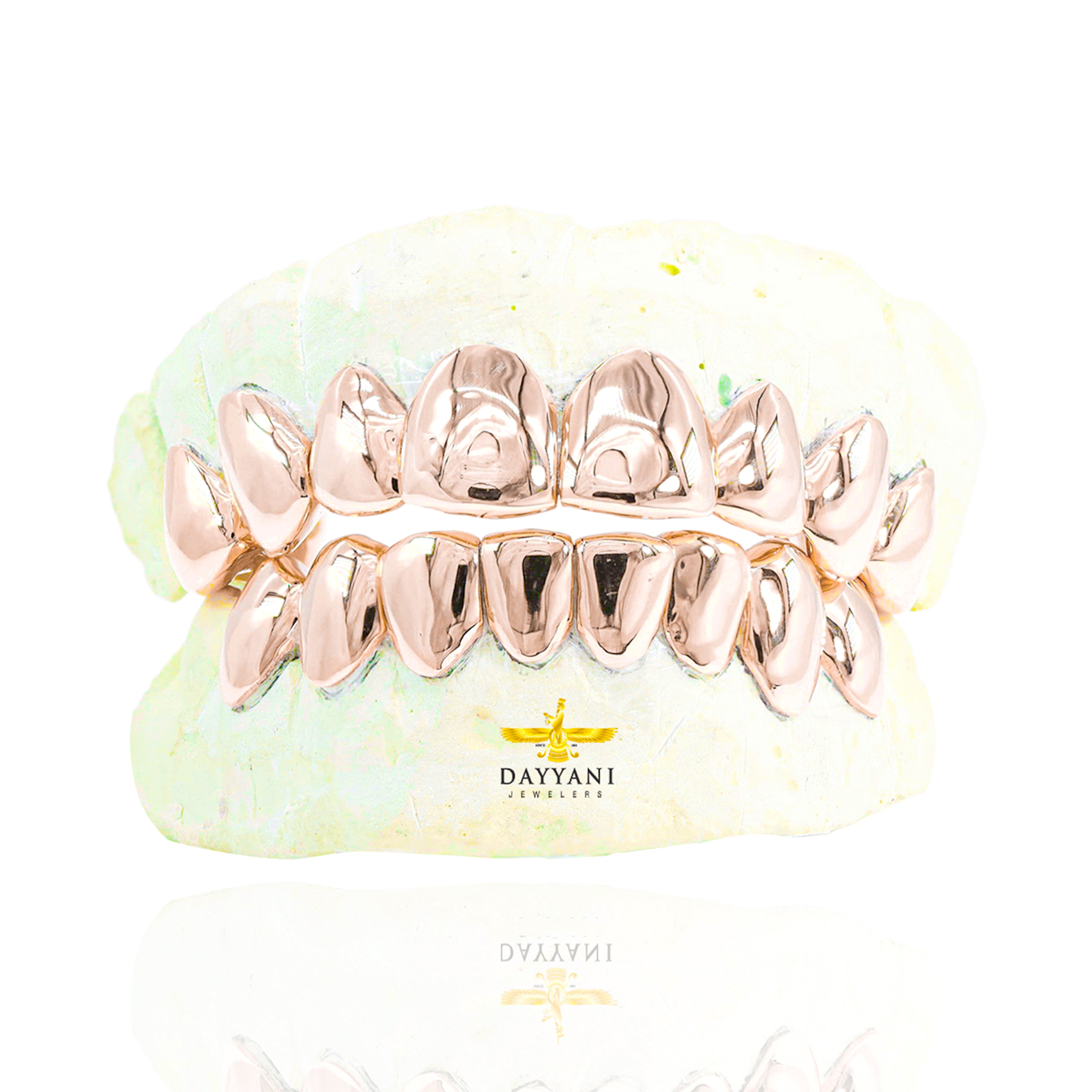 Custom Grillz Solid Gold Grillz