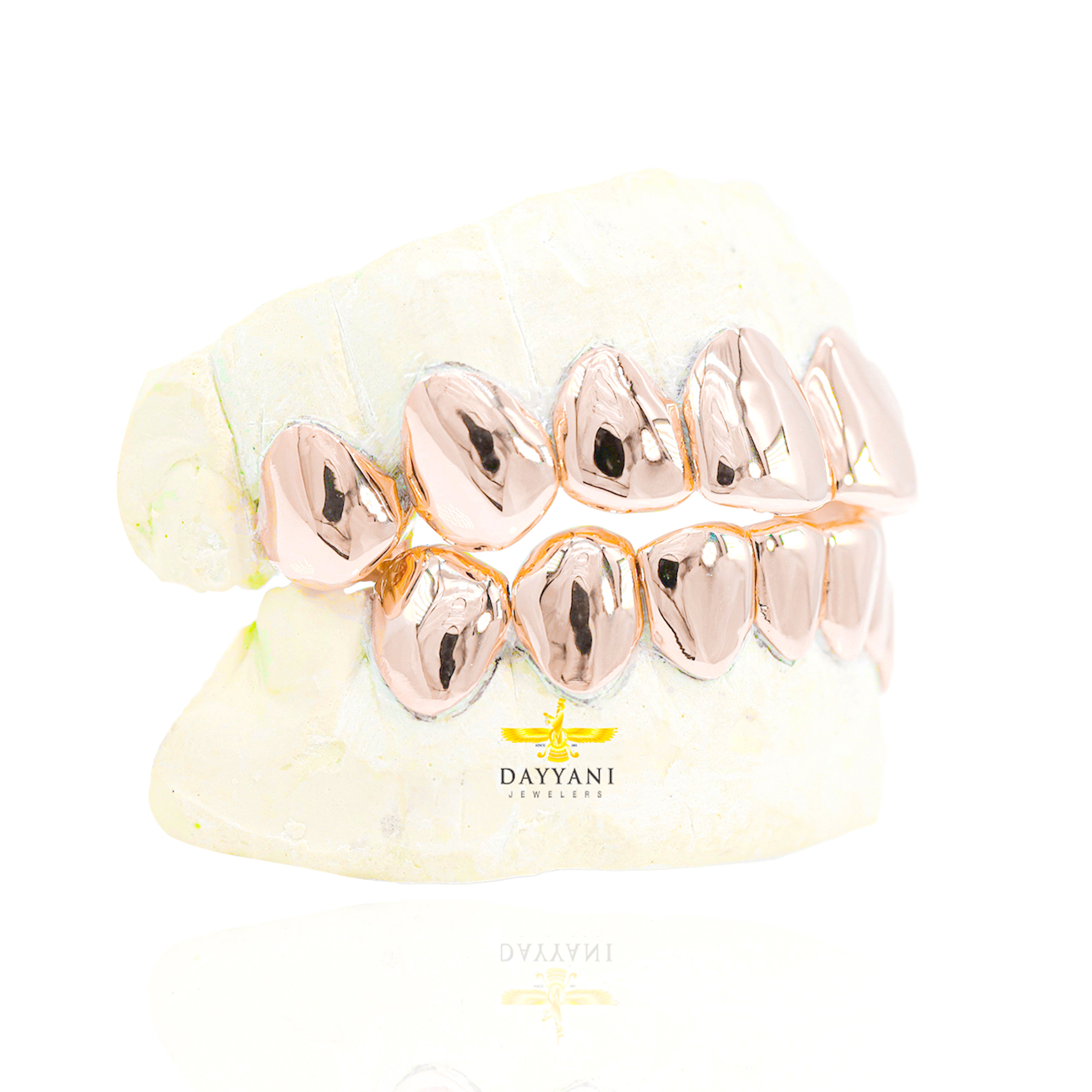 Custom Grillz Solid Gold Grillz