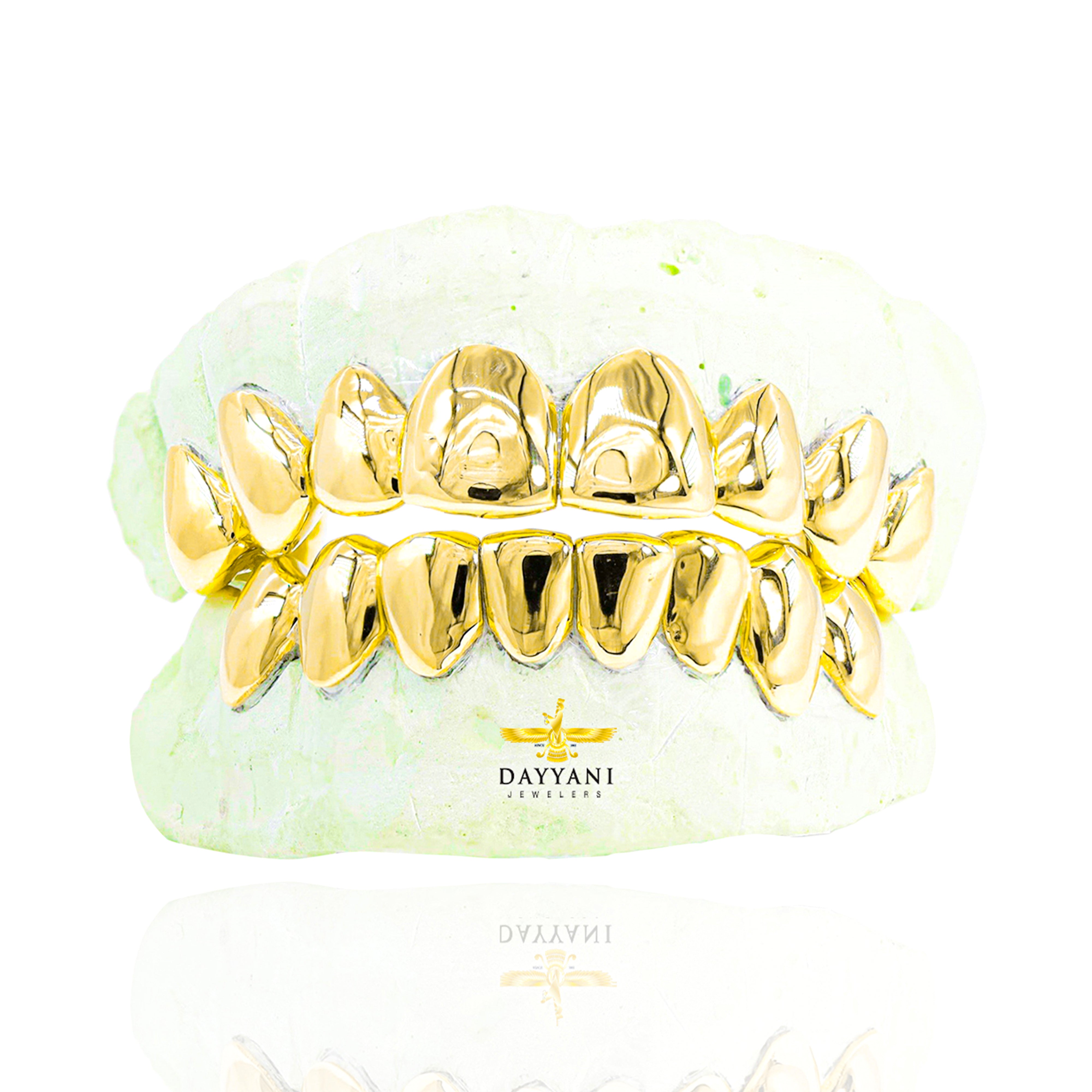 Custom Grillz Solid Gold Grillz