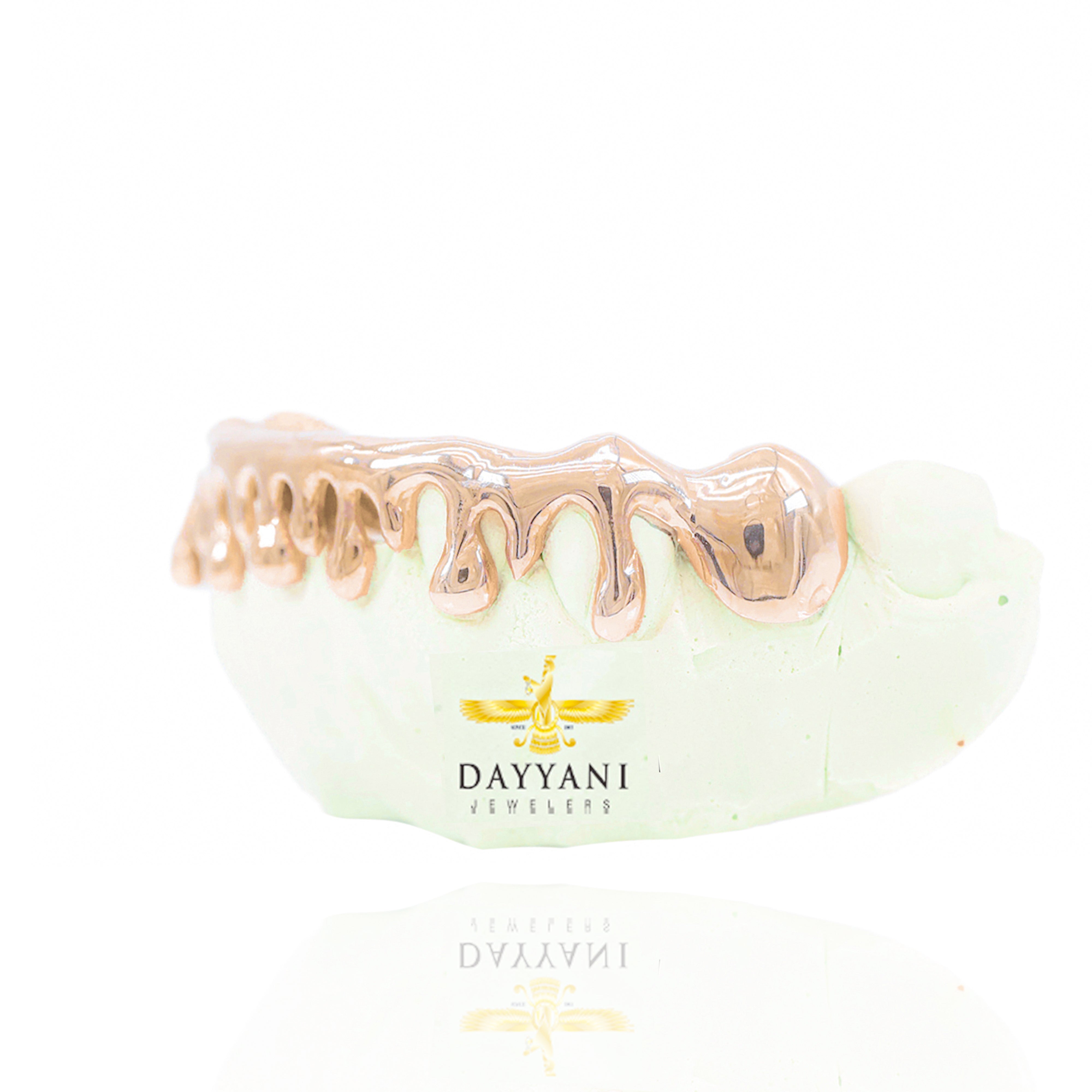 Custom Drip Style Gold Grillz