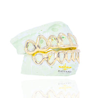 Custom Open Face Gold Grillz