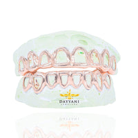 Custom Open Face Gold Grillz