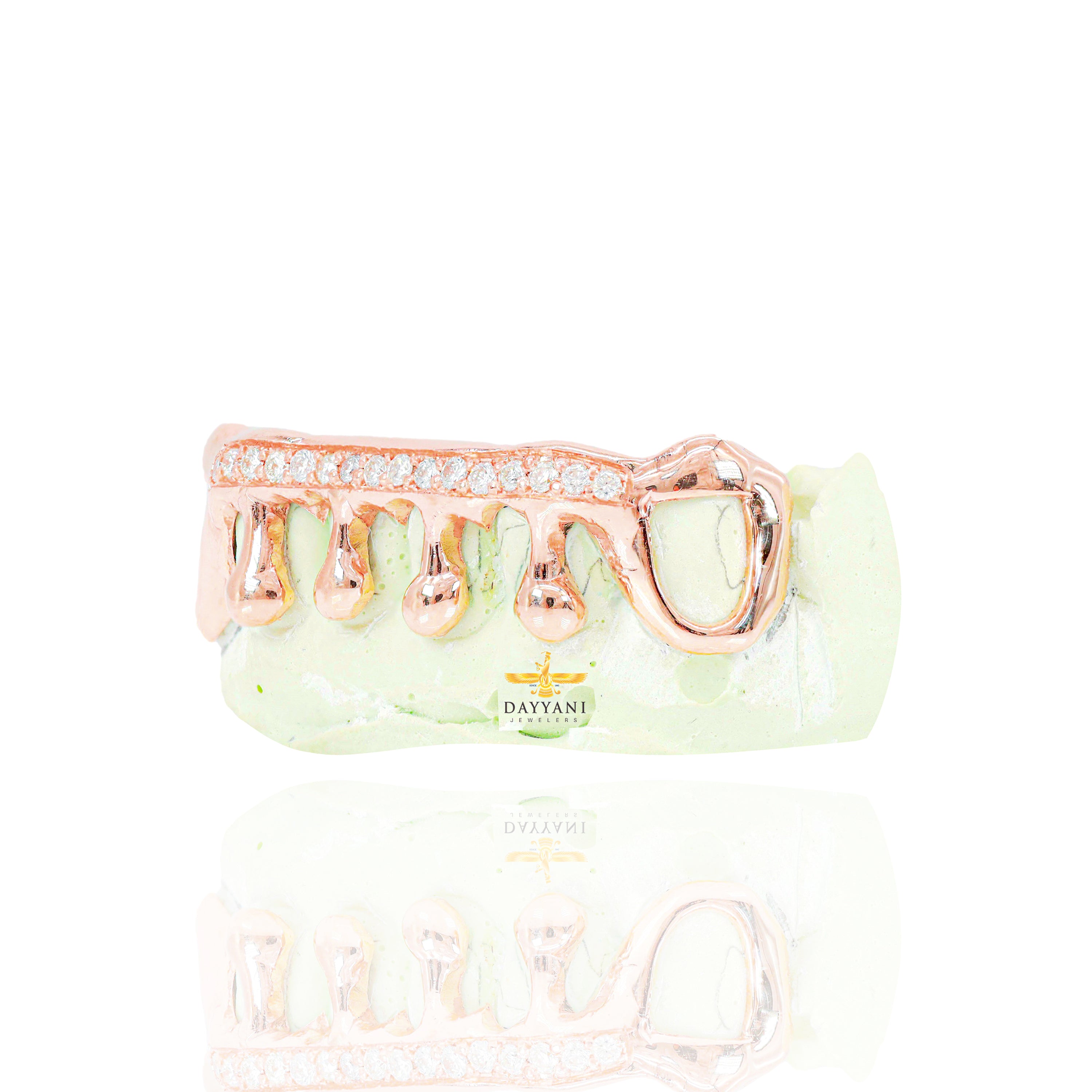 Custom One Row Diamond Bar with Solid Gold Drip Grillz