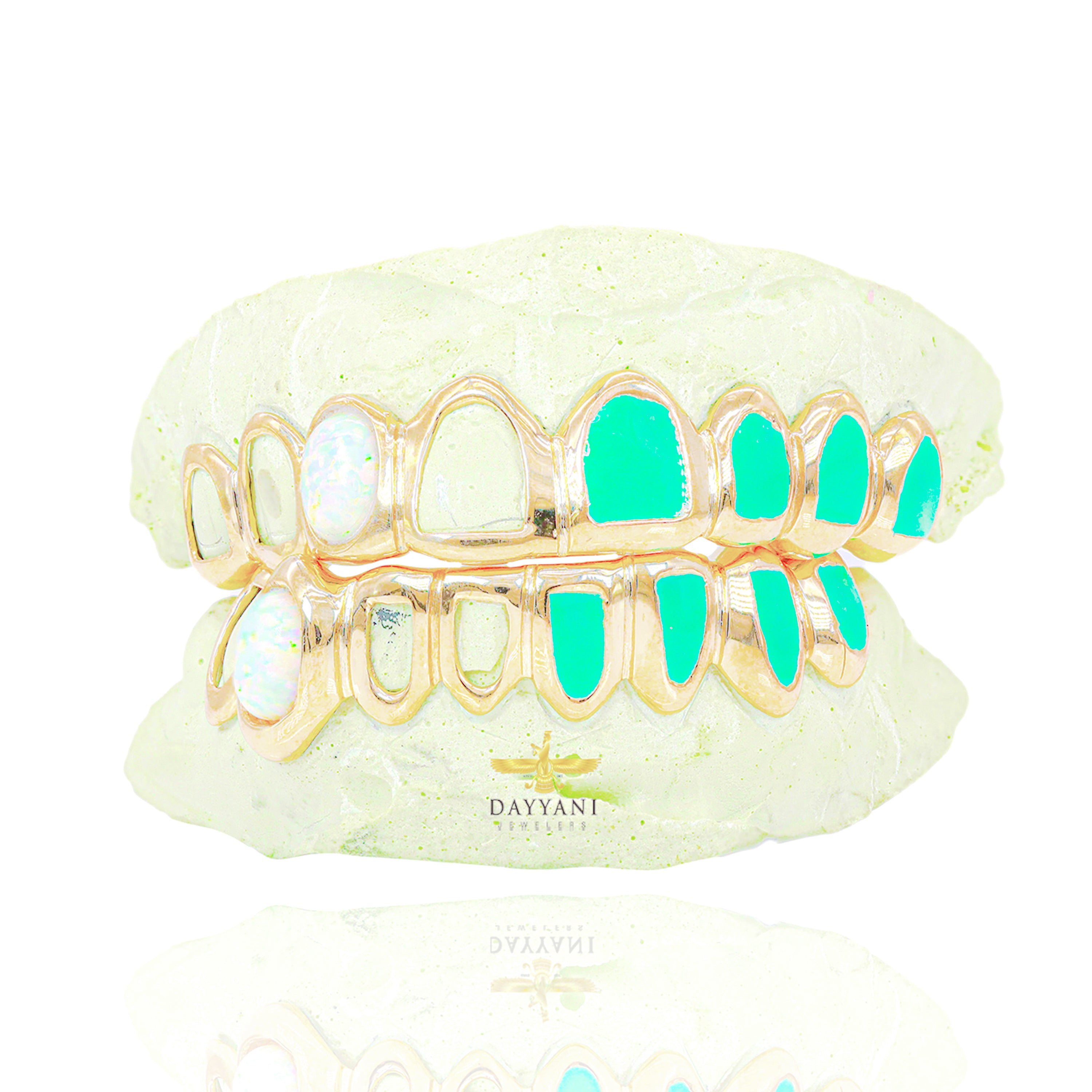 OFFICIAL Custom 8 on 8 FAT NWIGWE 'Mint Condition' Gold Grillz