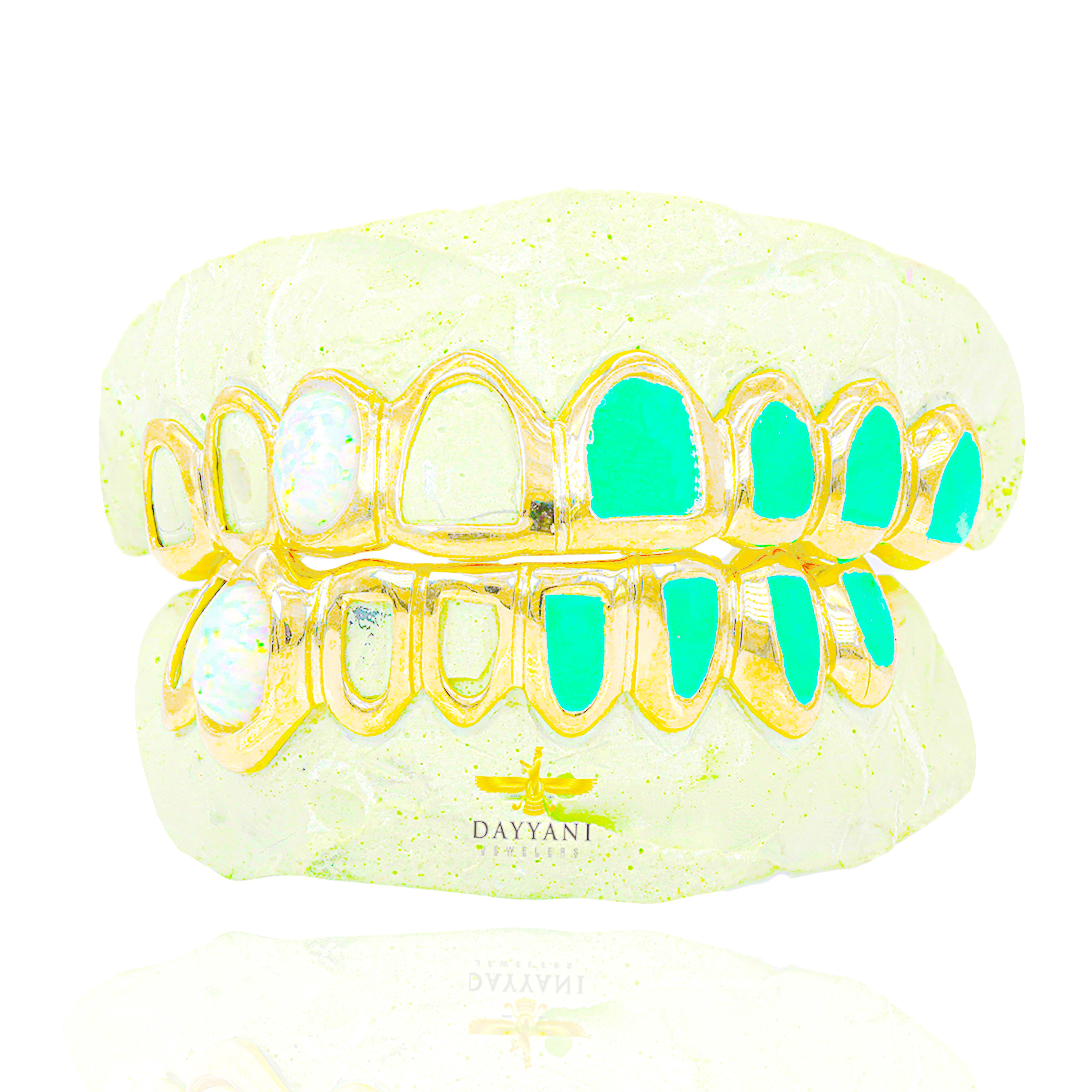 OFFICIAL Custom 8 on 8 FAT NWIGWE 'Mint Condition' Gold Grillz