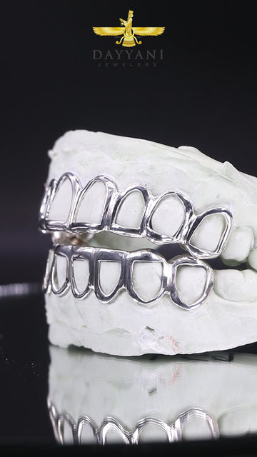Custom Open Face Gold Grillz
