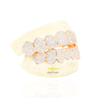 Custom SI Clarity Diamond Grillz Hand Set Natural Diamonds Gold Grillz (Zig-Zag Setting)