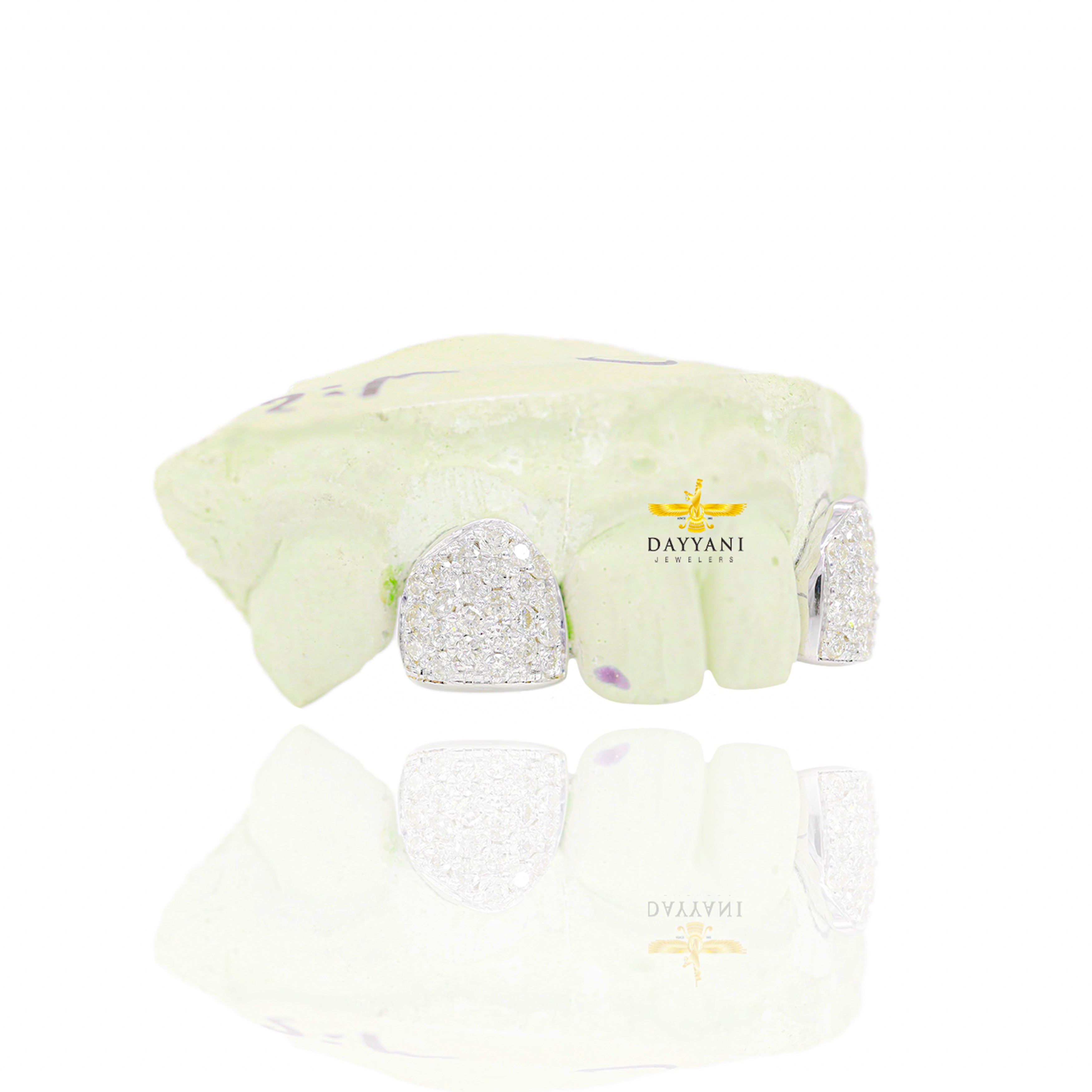 Custom 2 Teeth Incisors Diamond Grillz with Back Bar