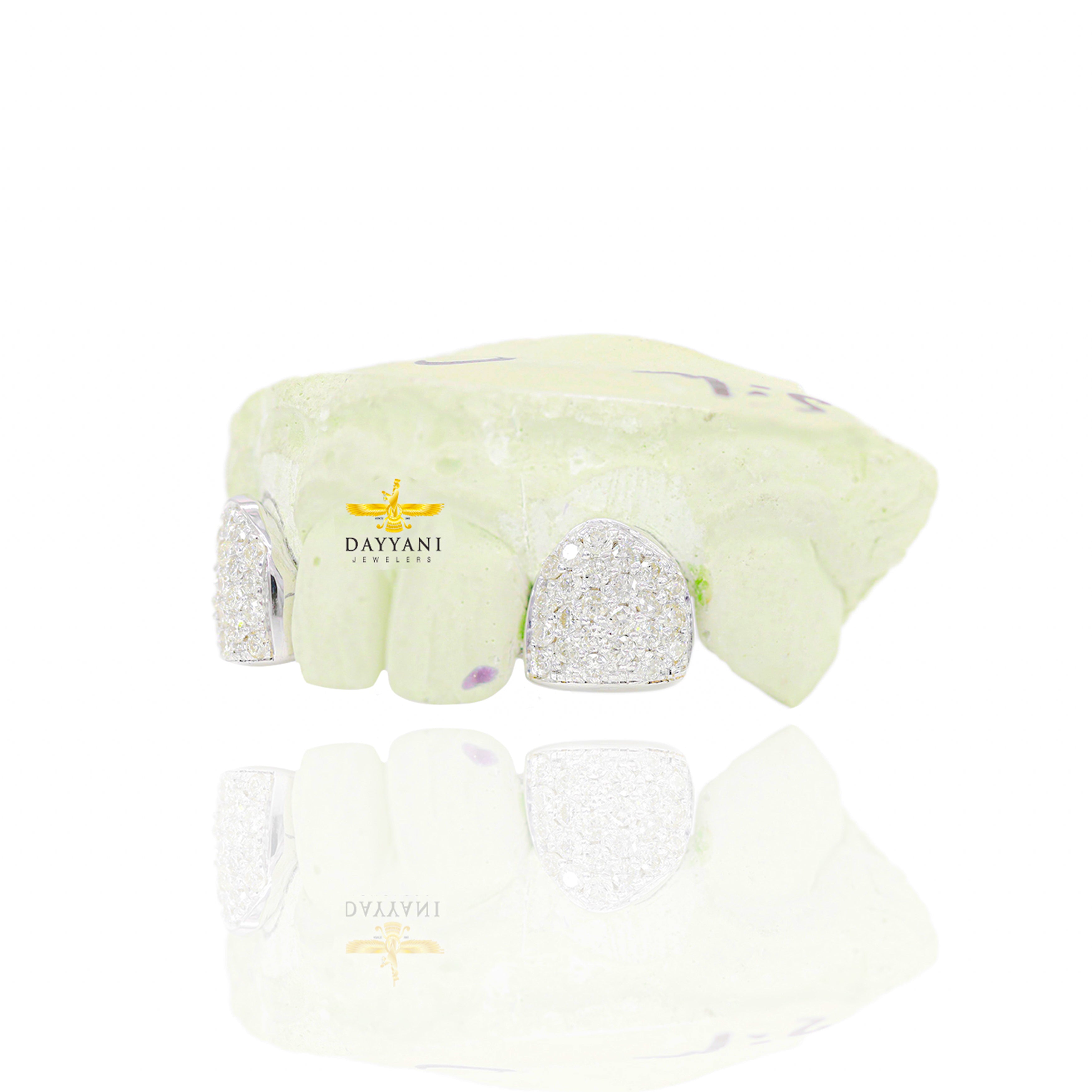 Custom 2 Teeth Incisors Diamond Grillz with Back Bar