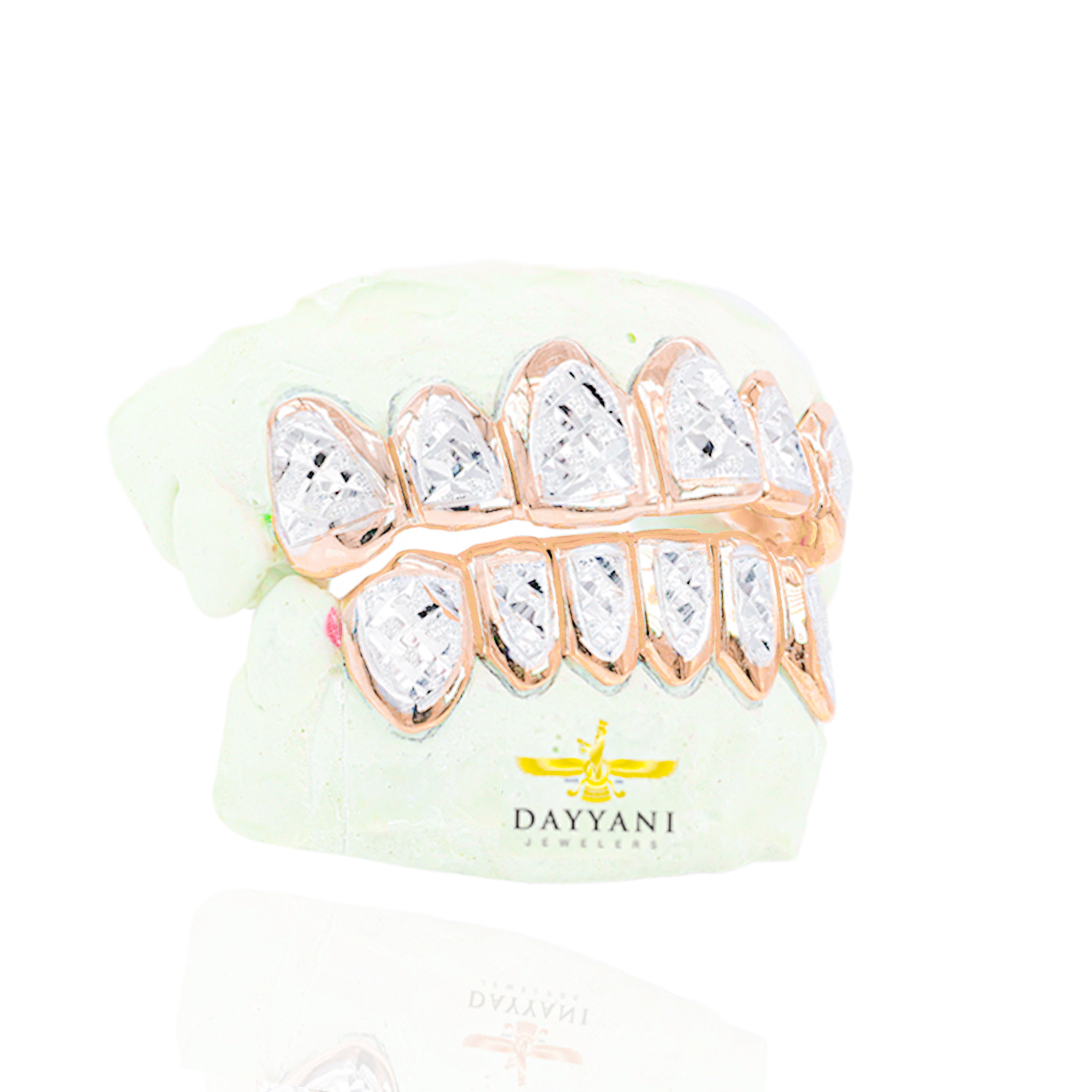 Custom Two-Tone Diamond Cut & Diamond Dust w/ Solid Trim Gold Grillz