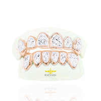 Custom Two-Tone Diamond Cut & Diamond Dust w/ Solid Trim Gold Grillz