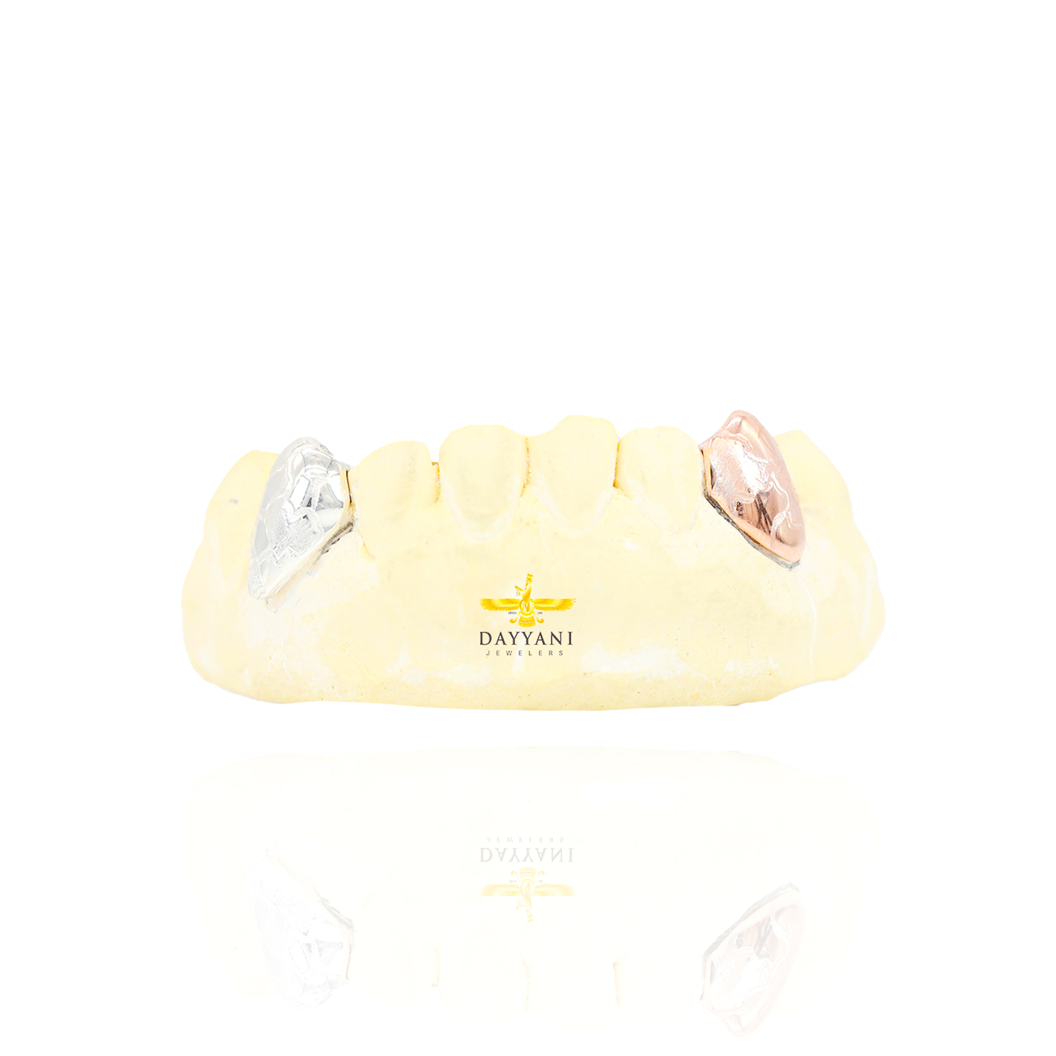 Custom Two-Tone 2 Teeth with Nugget Design Gold Grillz