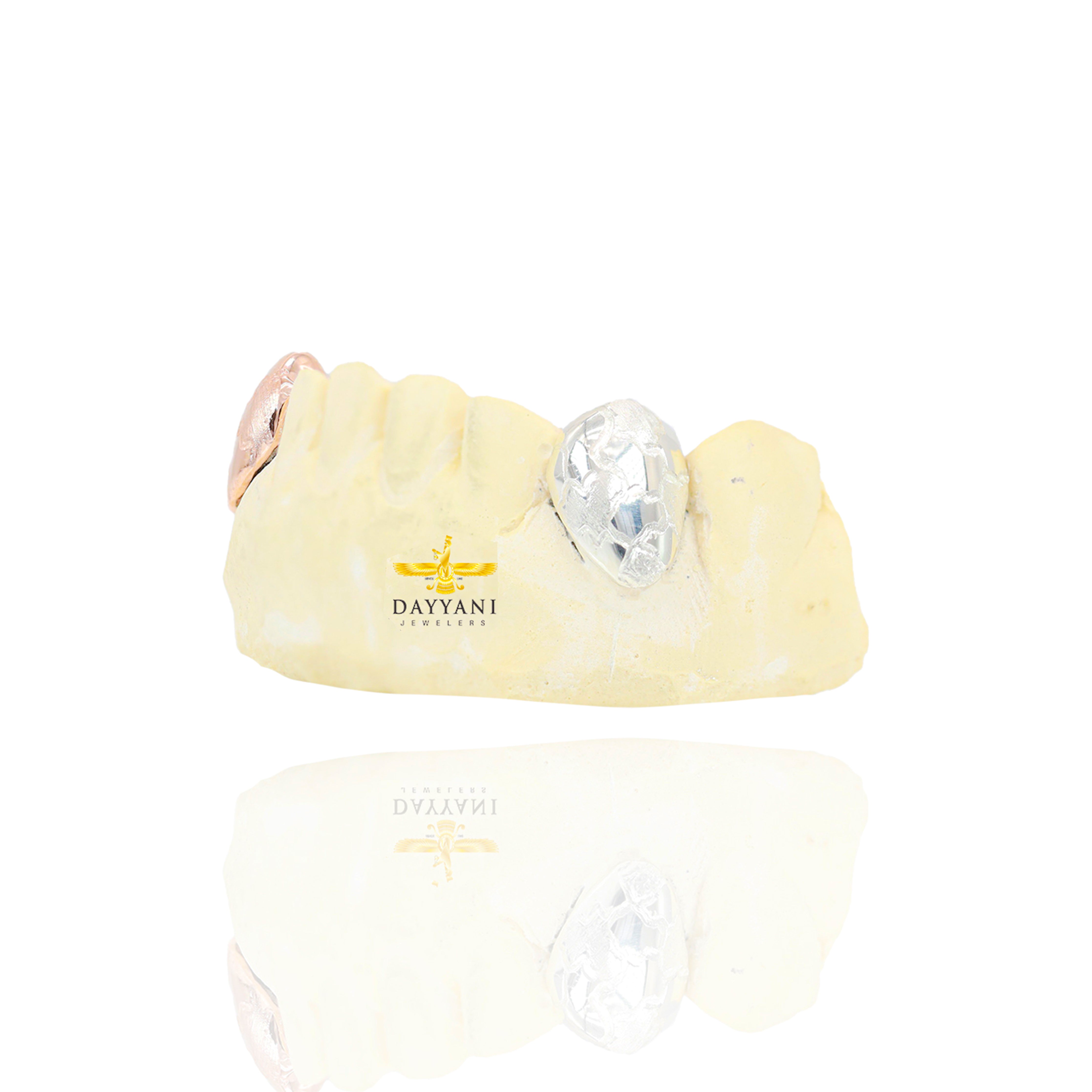 Custom Two-Tone 2 Teeth with Nugget Design Gold Grillz