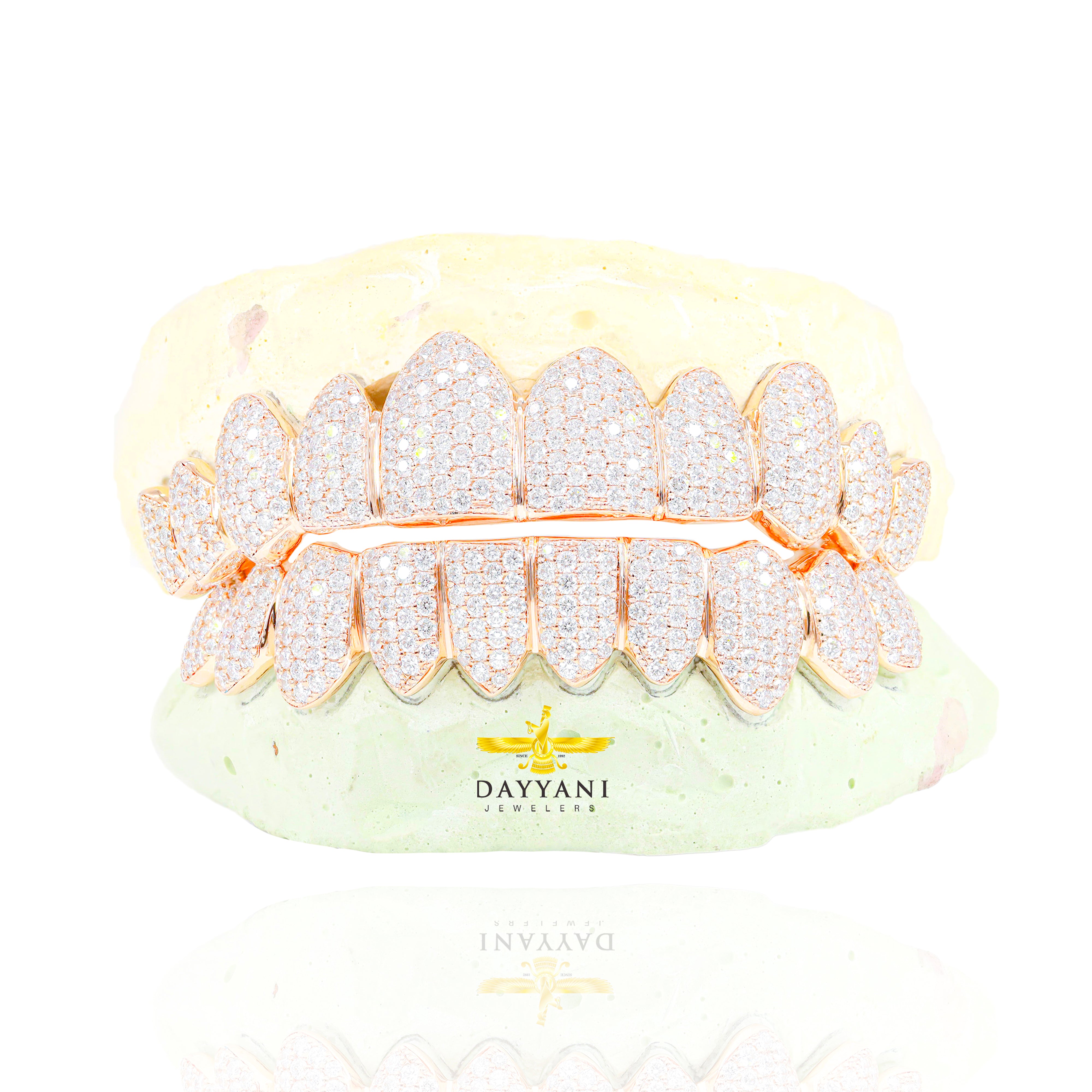 Custom VVS Clarity Diamond Grillz Hand Set Natural Diamonds Gold Grillz (Zig-Zag Setting)