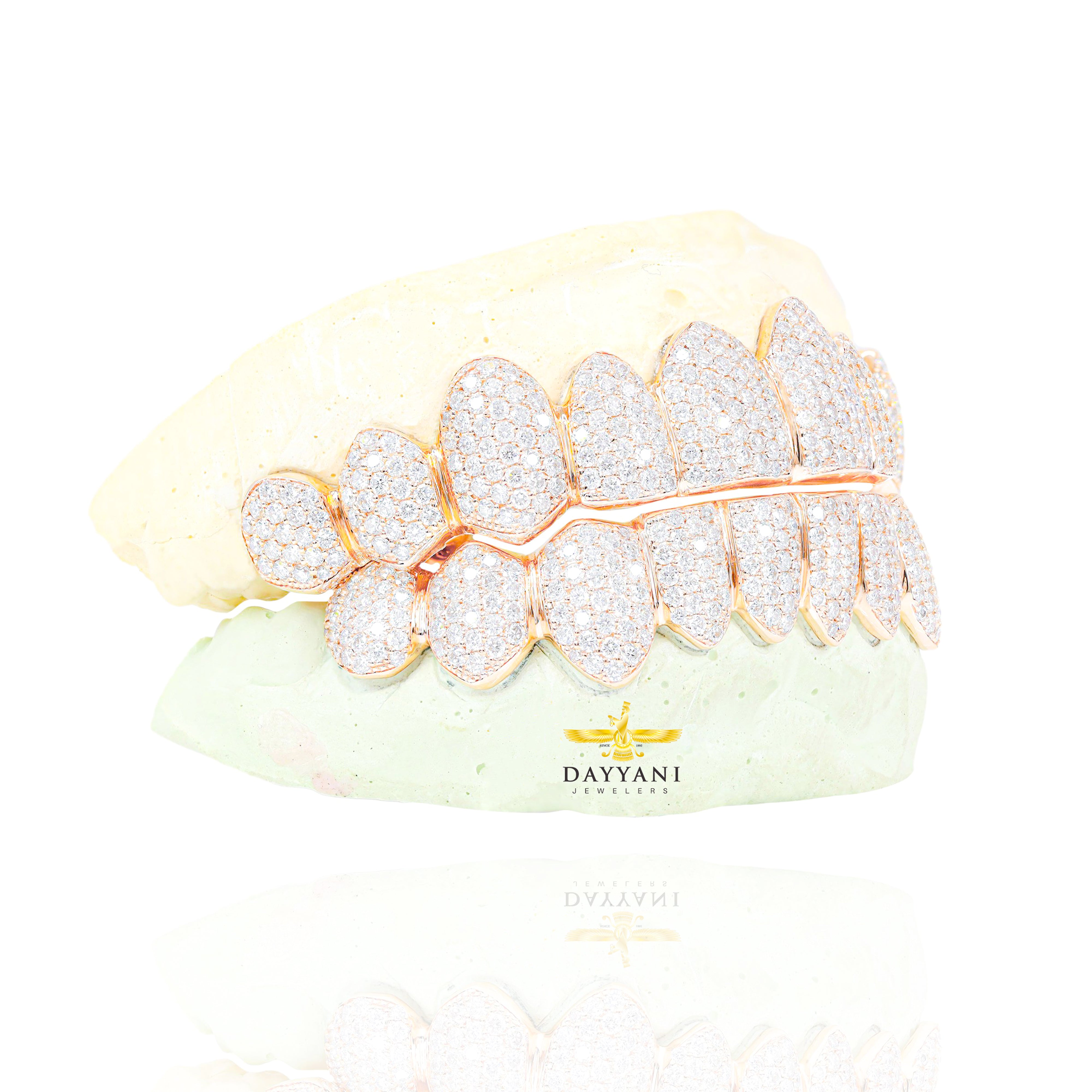 Custom VVS Clarity Diamond Grillz Hand Set Natural Diamonds Gold Grillz (Zig-Zag Setting)