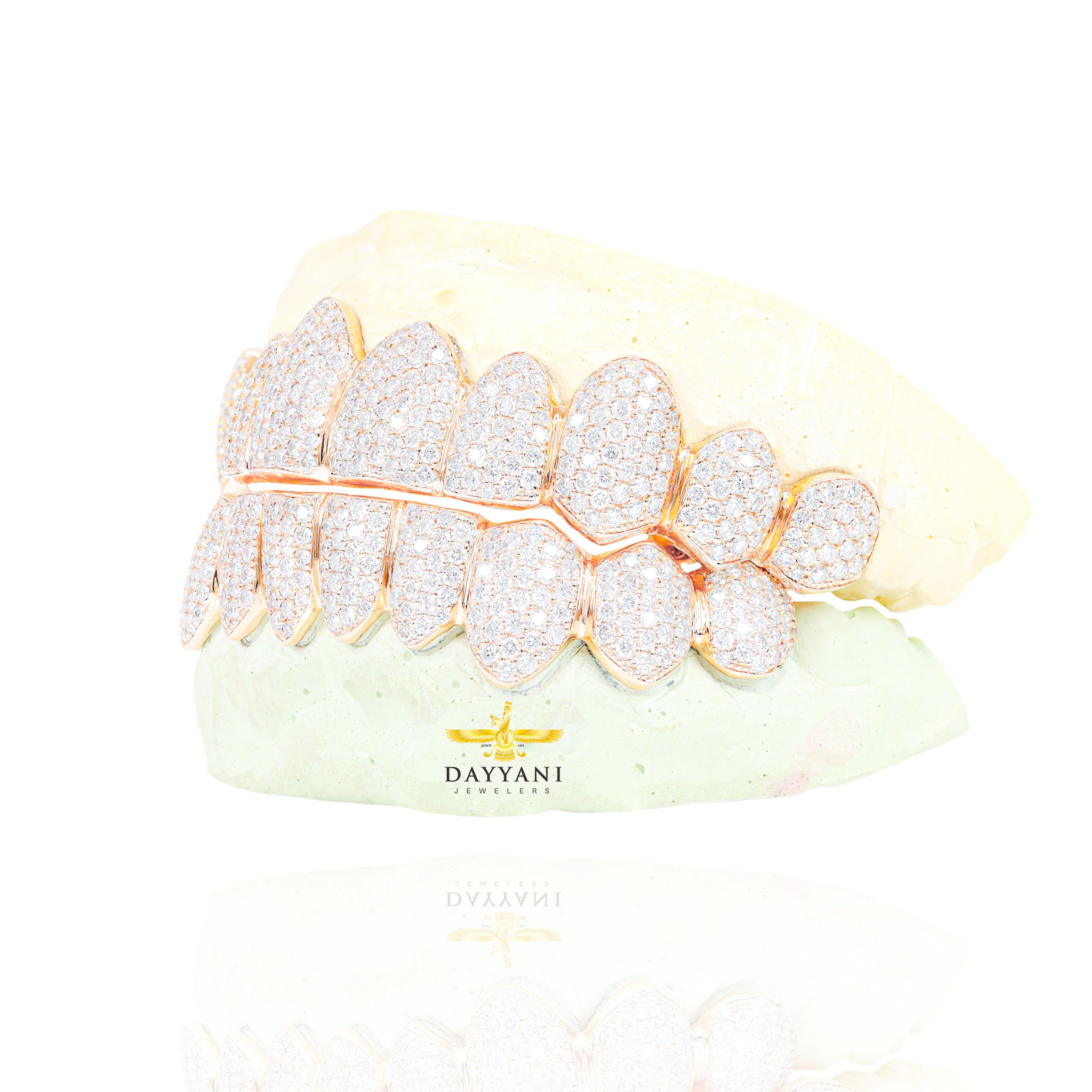 Custom VVS Clarity Diamond Grillz Hand Set Natural Diamonds Gold Grillz (Zig-Zag Setting)