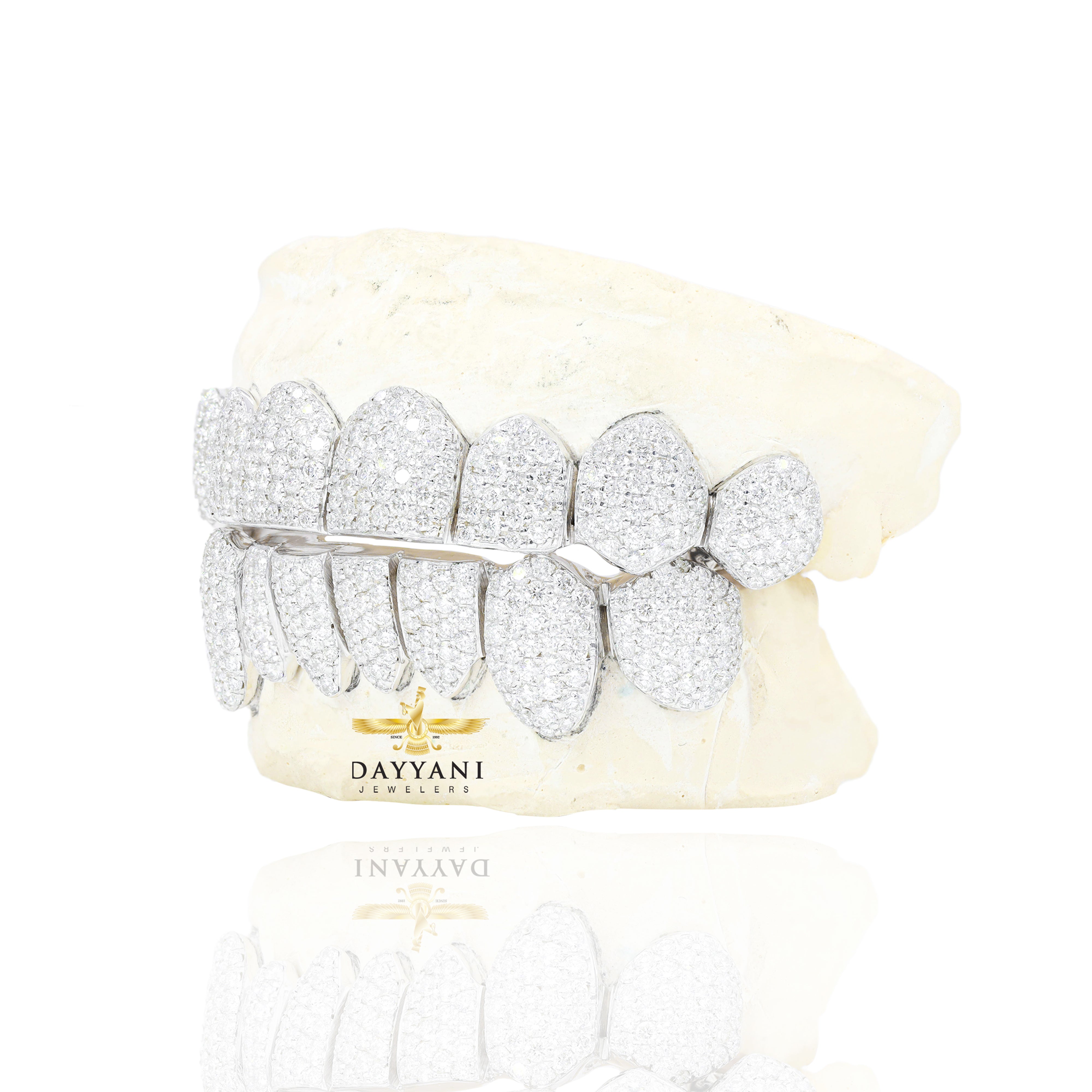 Custom VVS Clarity Diamond Grillz Hand Set Natural Diamonds Gold Grillz (Zig-Zag Setting)