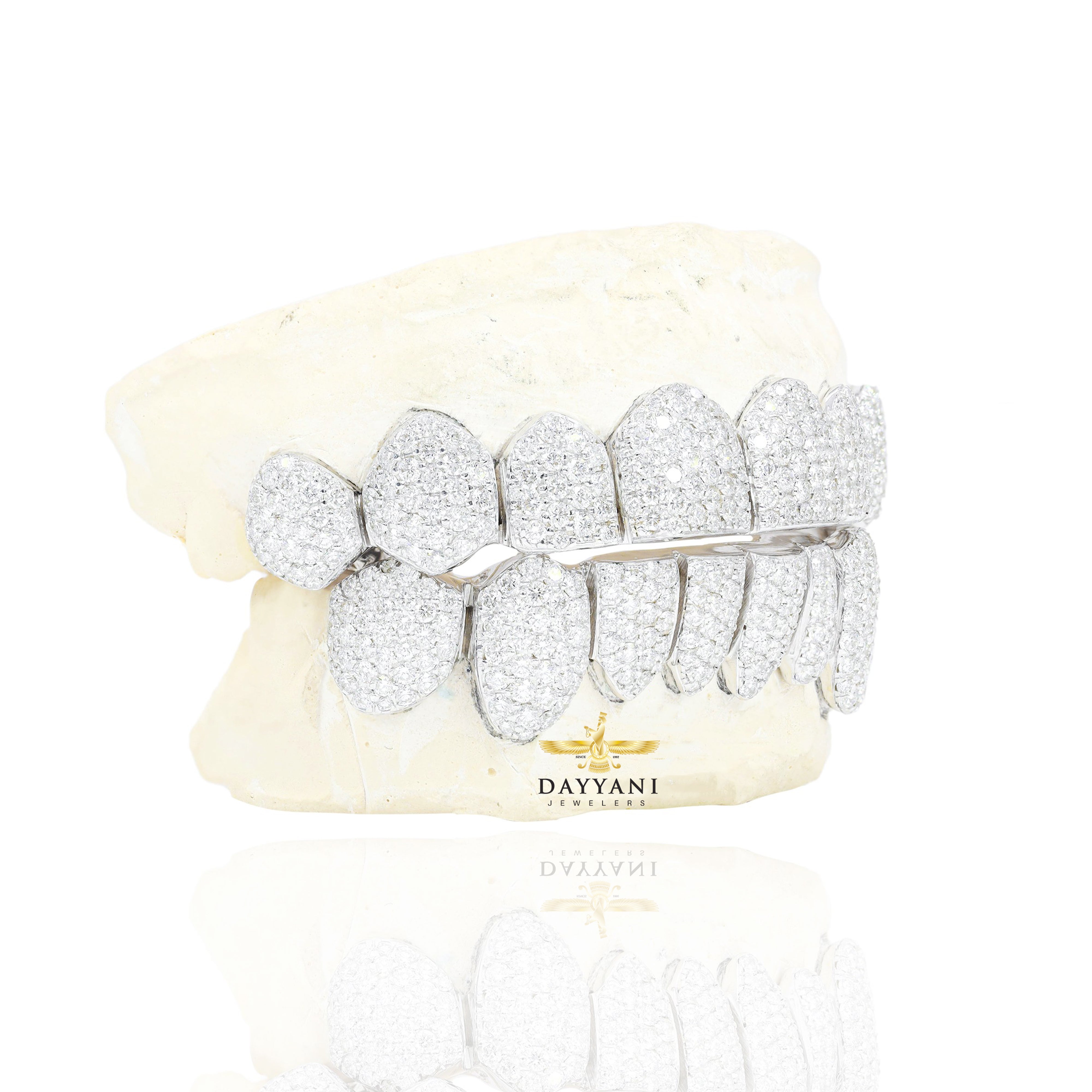 Custom VVS Clarity Diamond Grillz Hand Set Natural Diamonds Gold Grillz (Zig-Zag Setting)