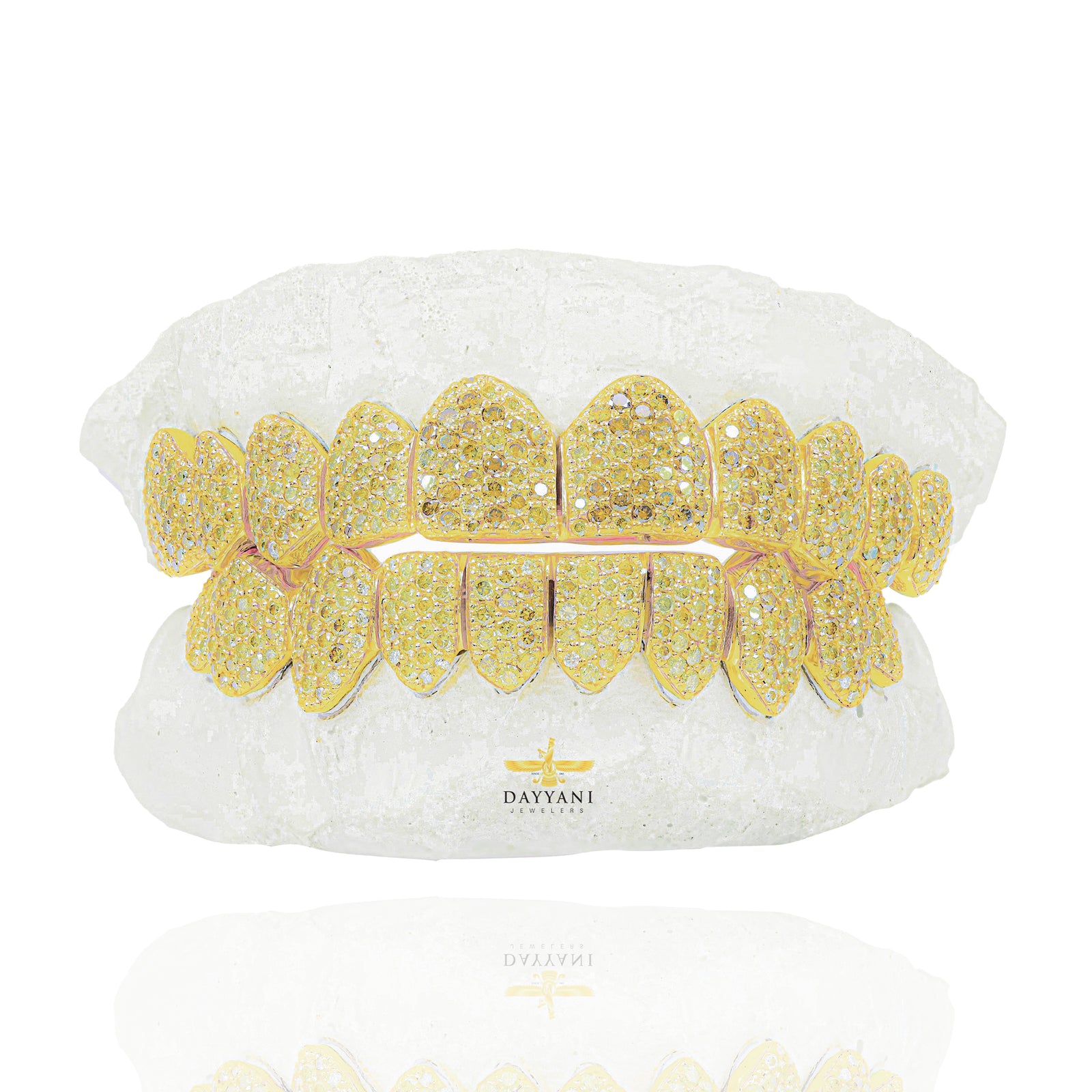 Custom Canary Diamond Gold Grillz (ZigZag Setting)