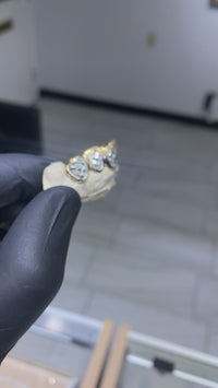 Custom Two-Tone Diamond Cut & Diamond Dust w/ Solid Trim Gold Grillz