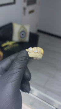 Custom I Clarity Diamond Grillz Hand Set Natural Diamonds Gold Grillz (Zig-Zag Setting)